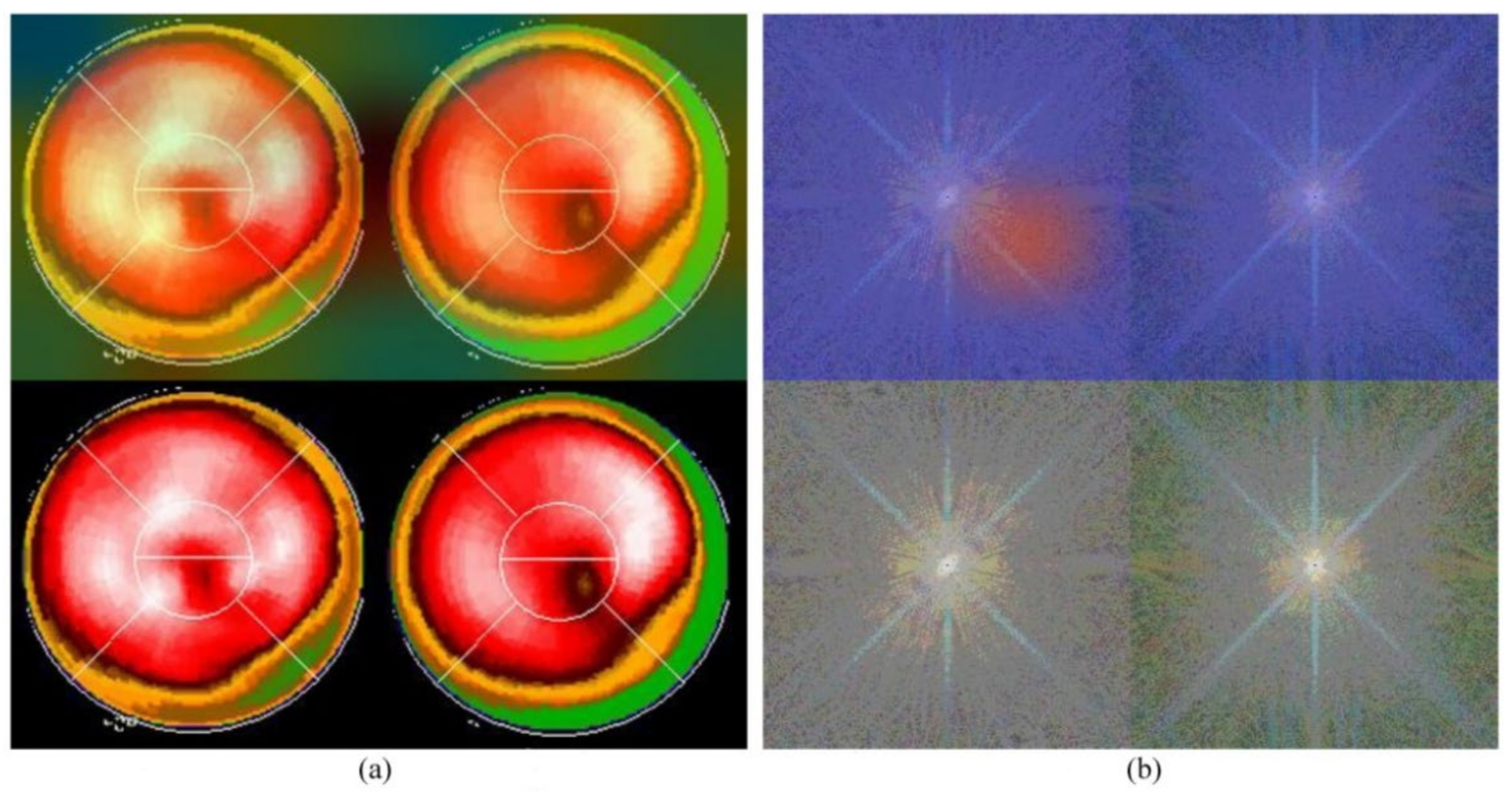 Jpm 12 01105 g006 550