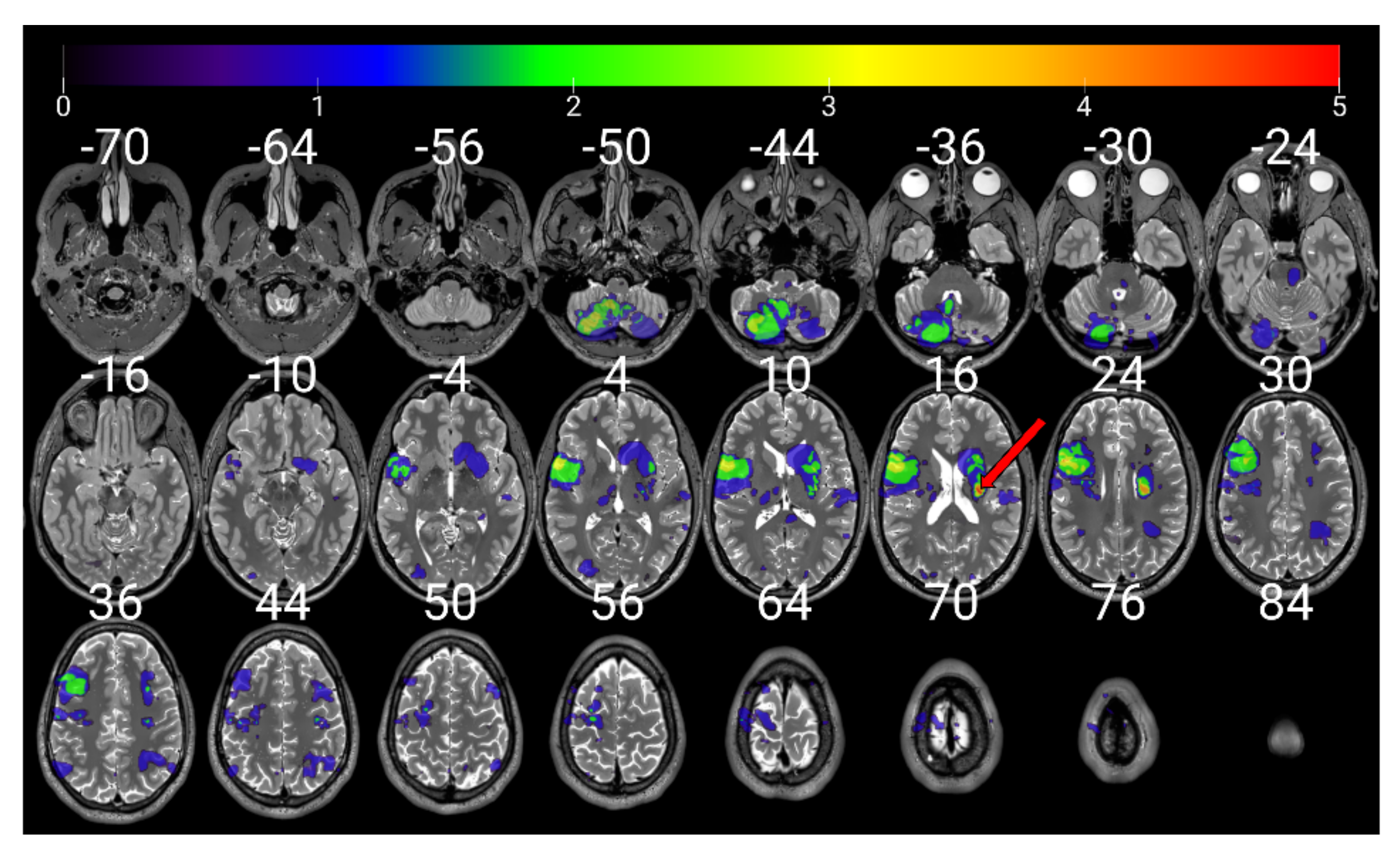Jpm 12 01109 g004 Jpm 12 01109 g004