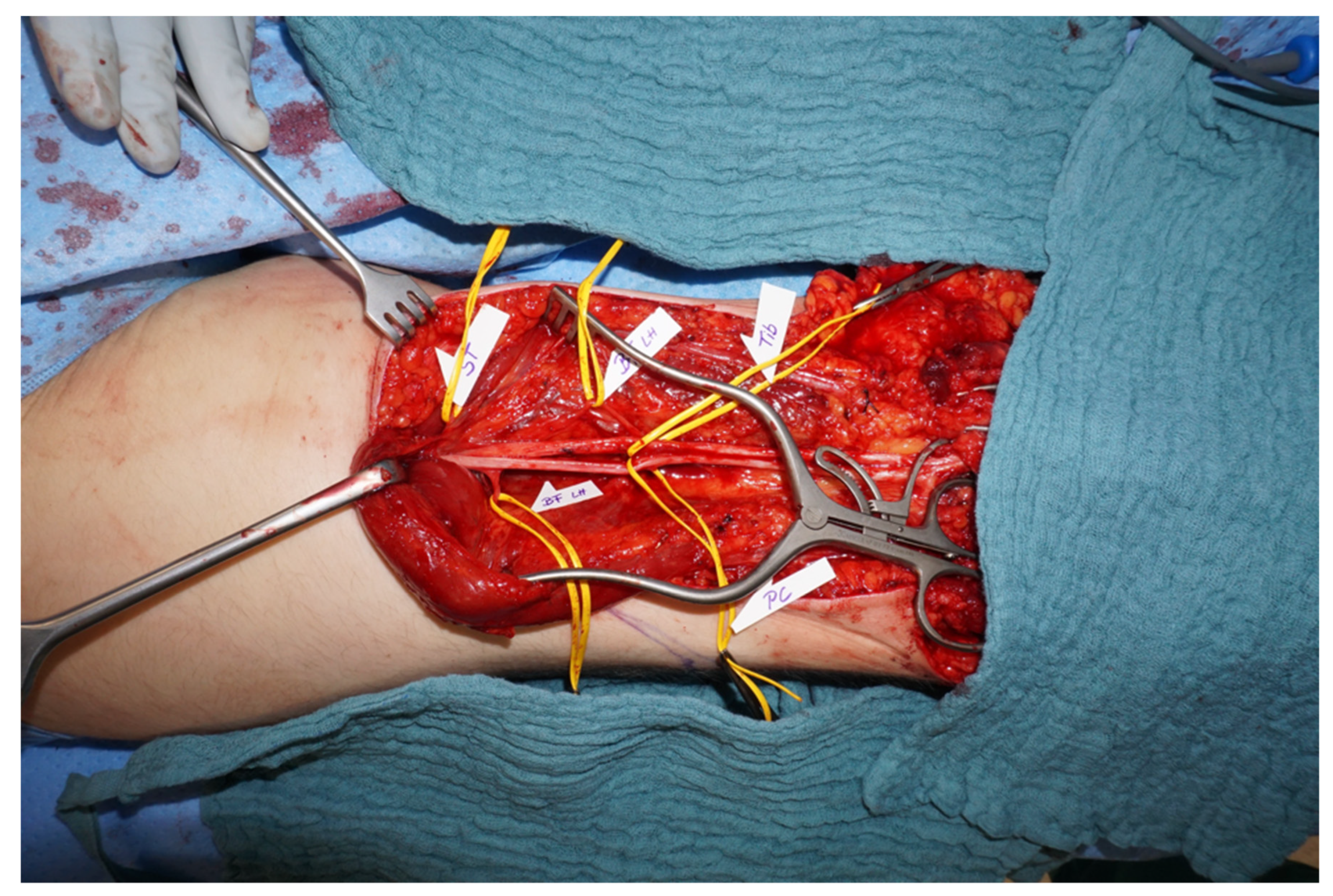 Jpm 12 01169 g004 Jpm 12 01169 g004