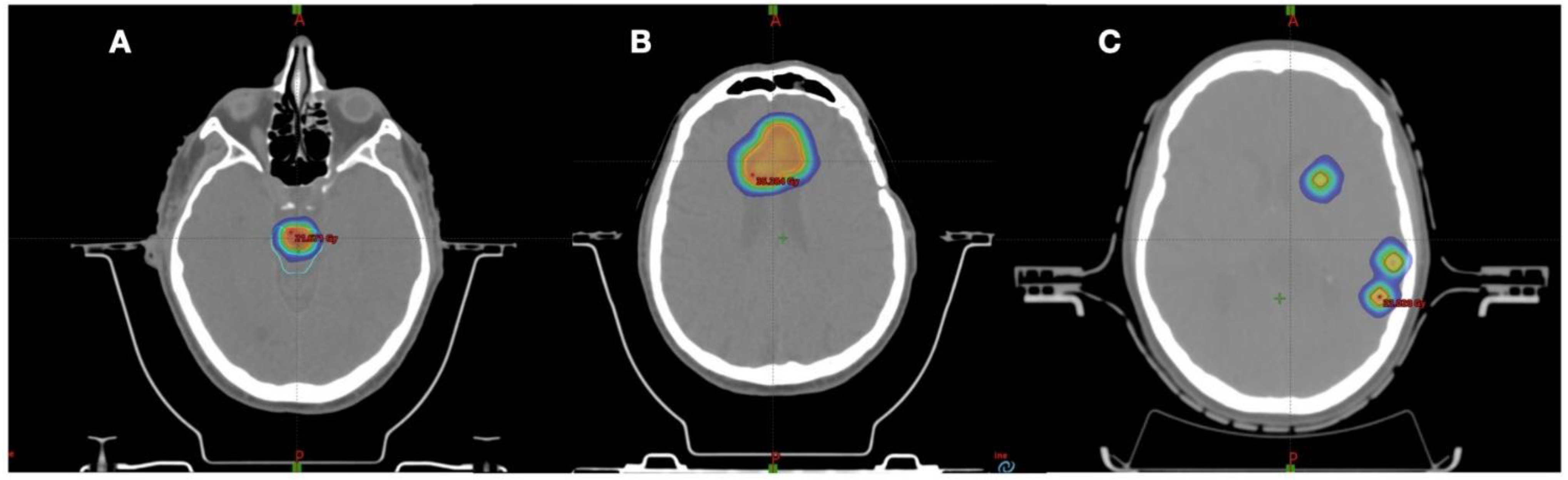 Jpm 12 01336 g001 550