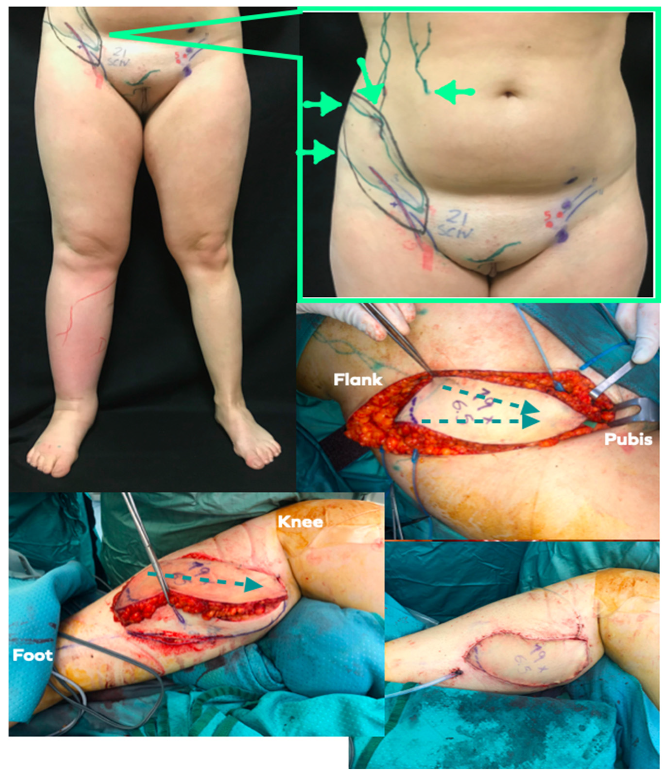 Jpm 12 01346 g004 550