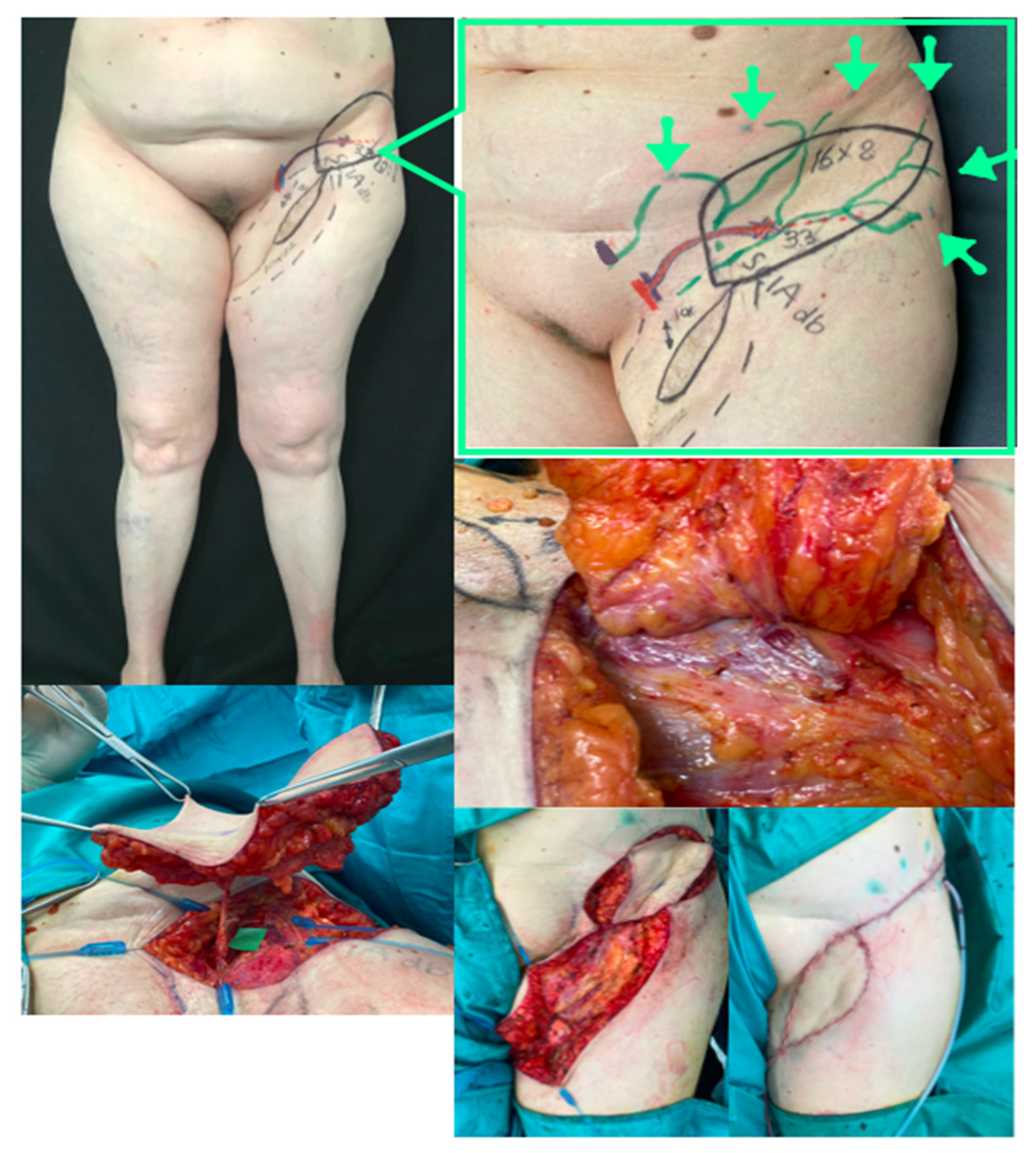 Jpm 12 01346 g005 550