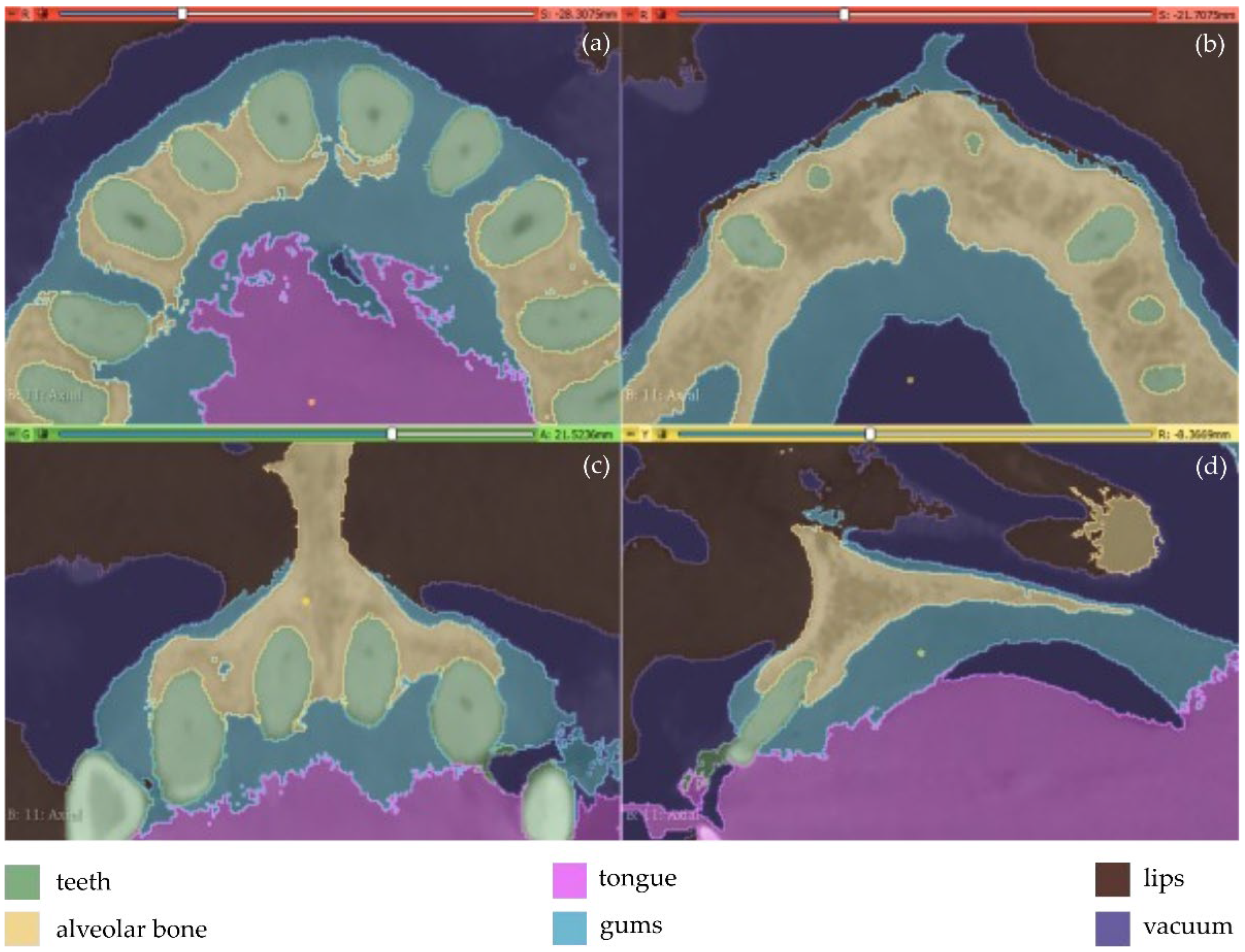Jpm 12 01355 g005 550