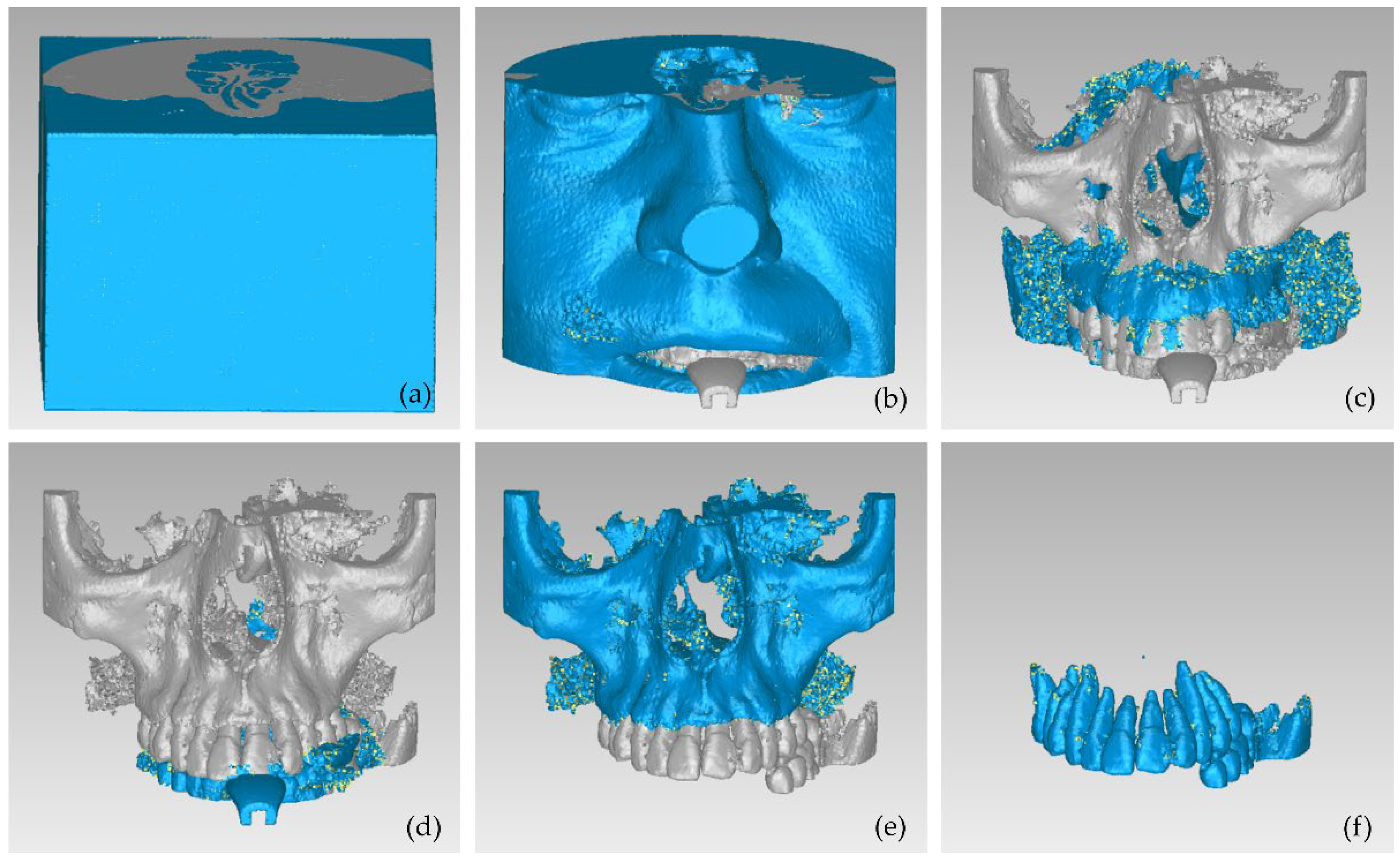 Jpm 12 01355 g006 550