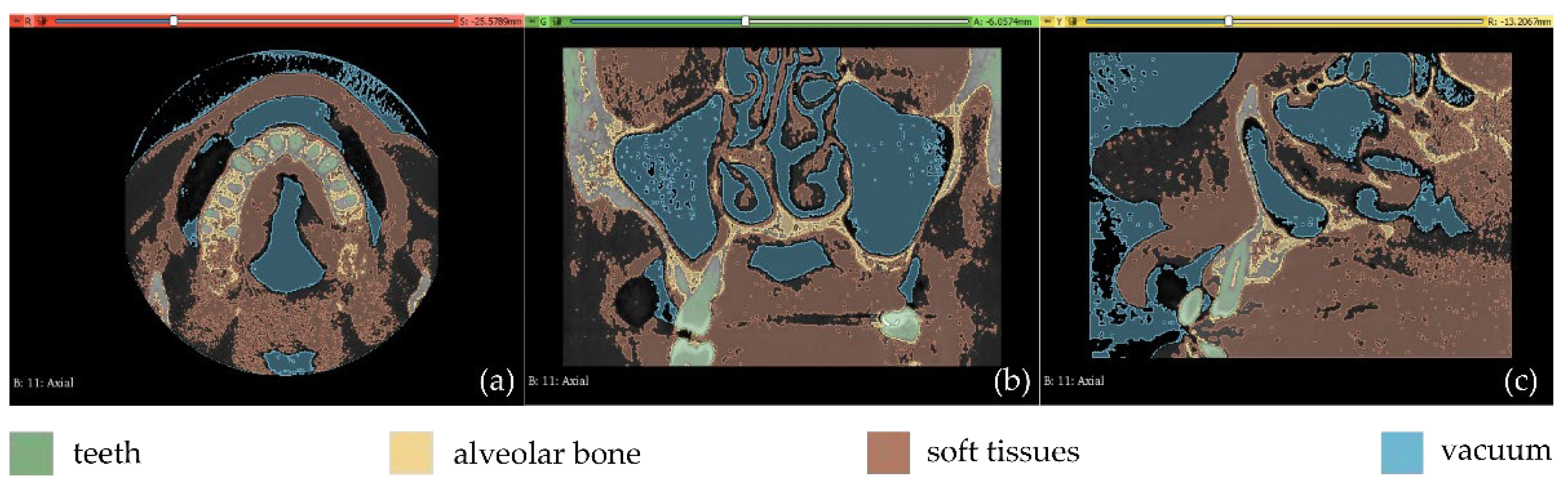 Jpm 12 01355 g008 550