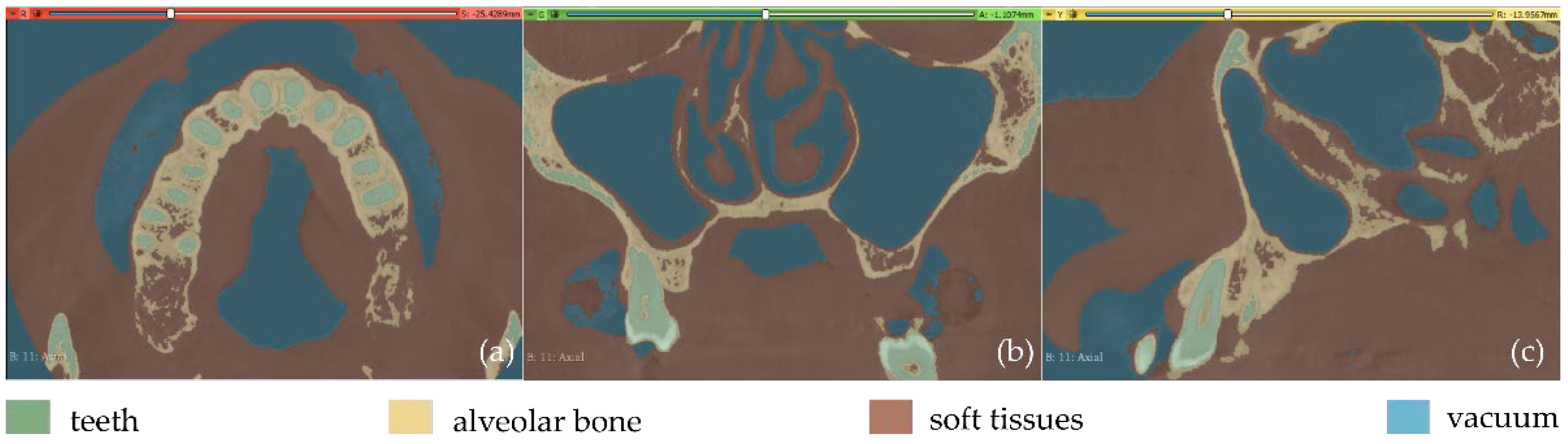 Jpm 12 01355 g010 550
