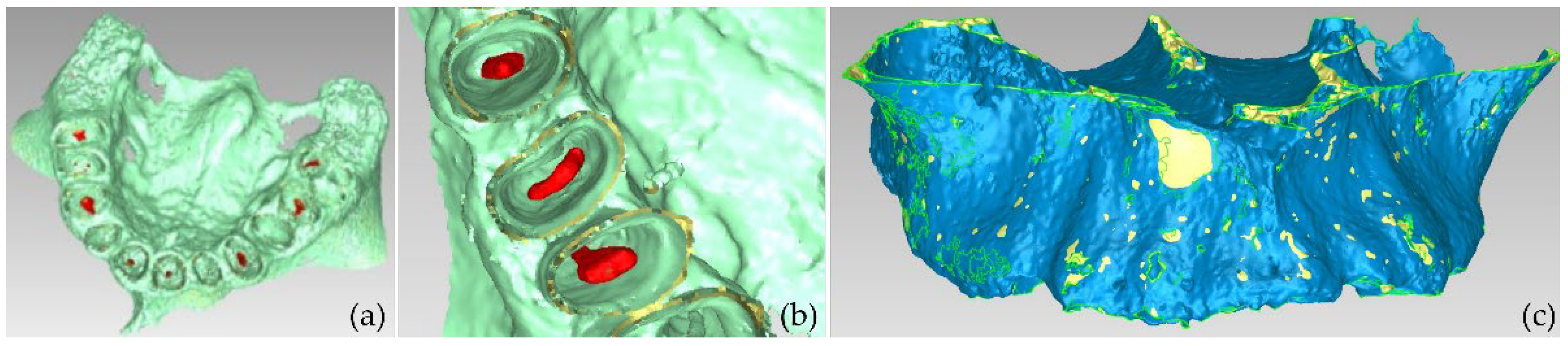 Jpm 12 01355 g011 550