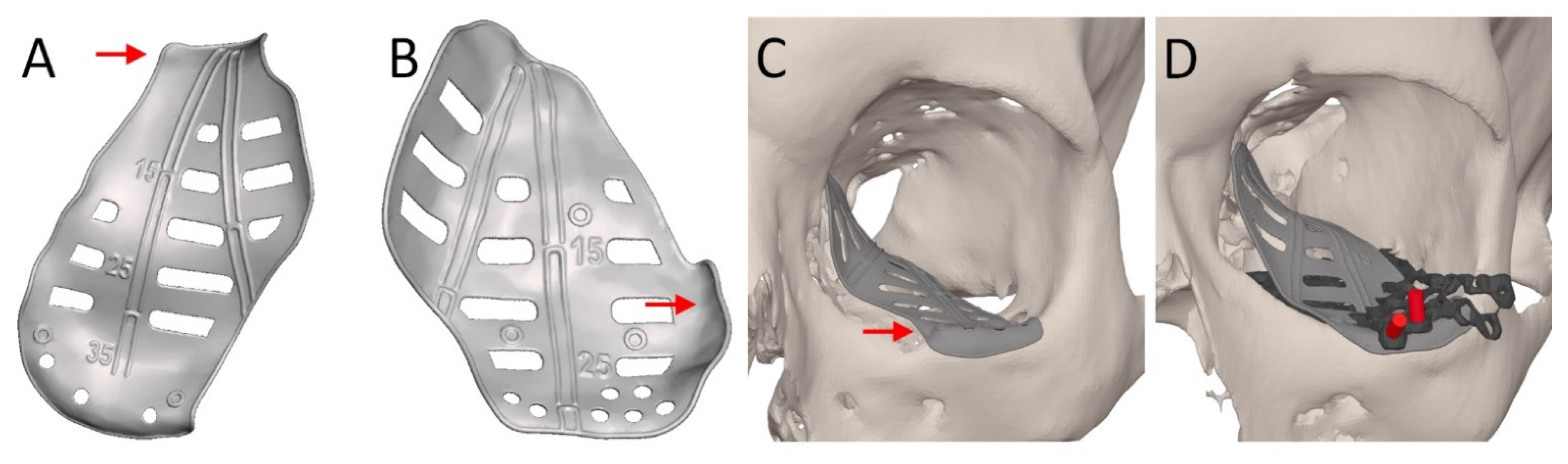 Jpm 12 01366 g007 550