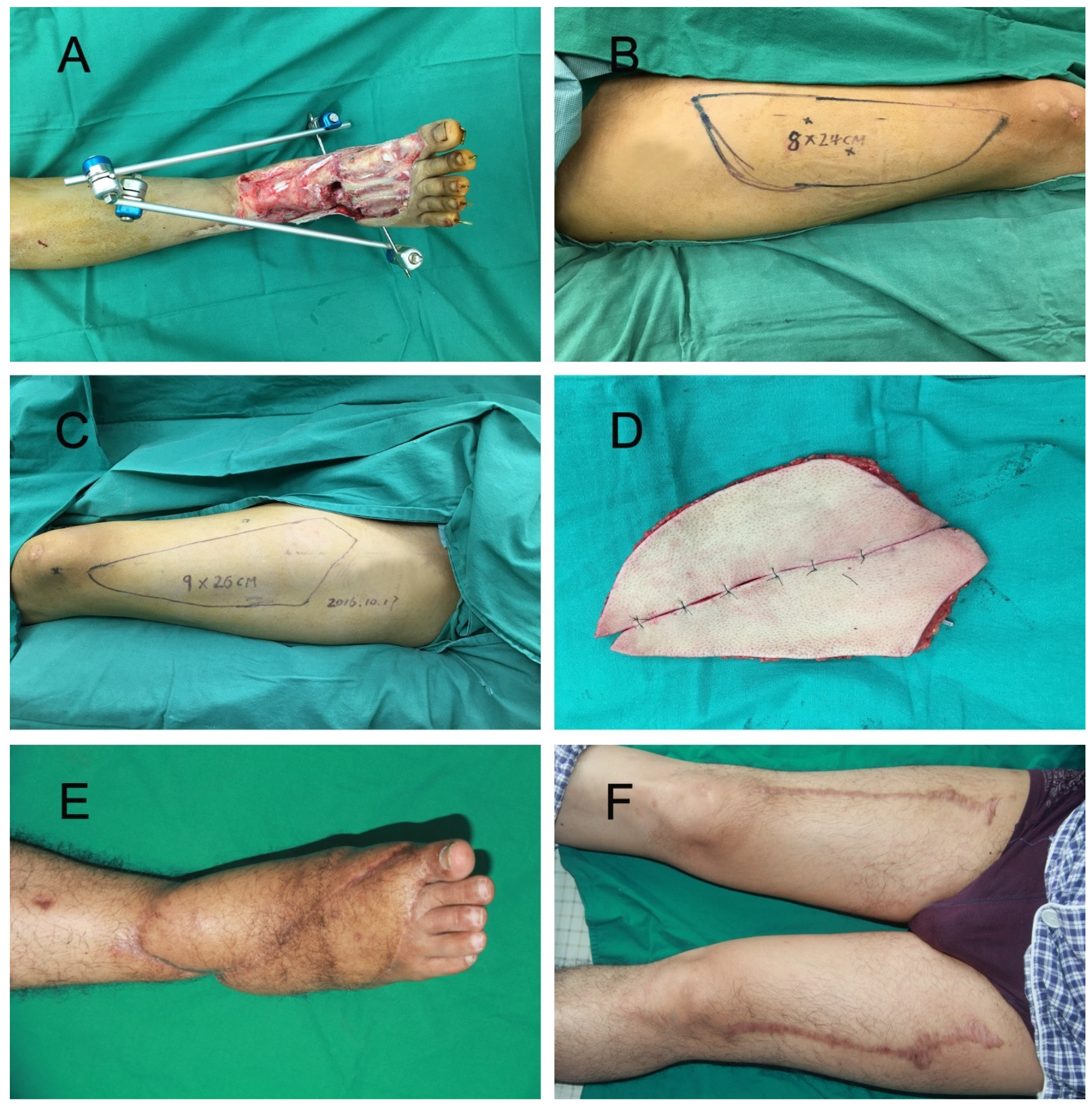 Jpm 12 01400 g001 550