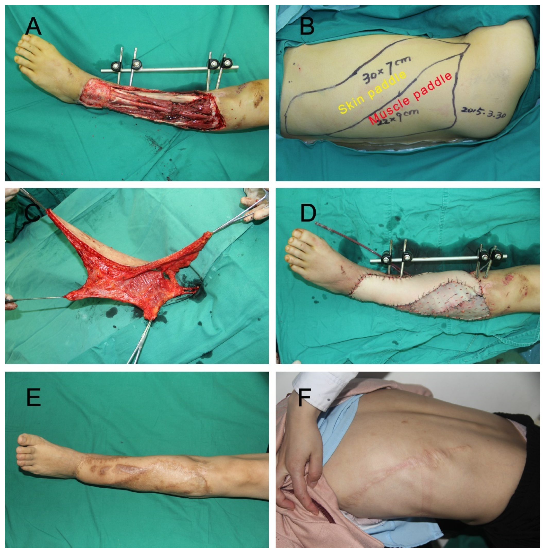 Jpm 12 01400 g002 550