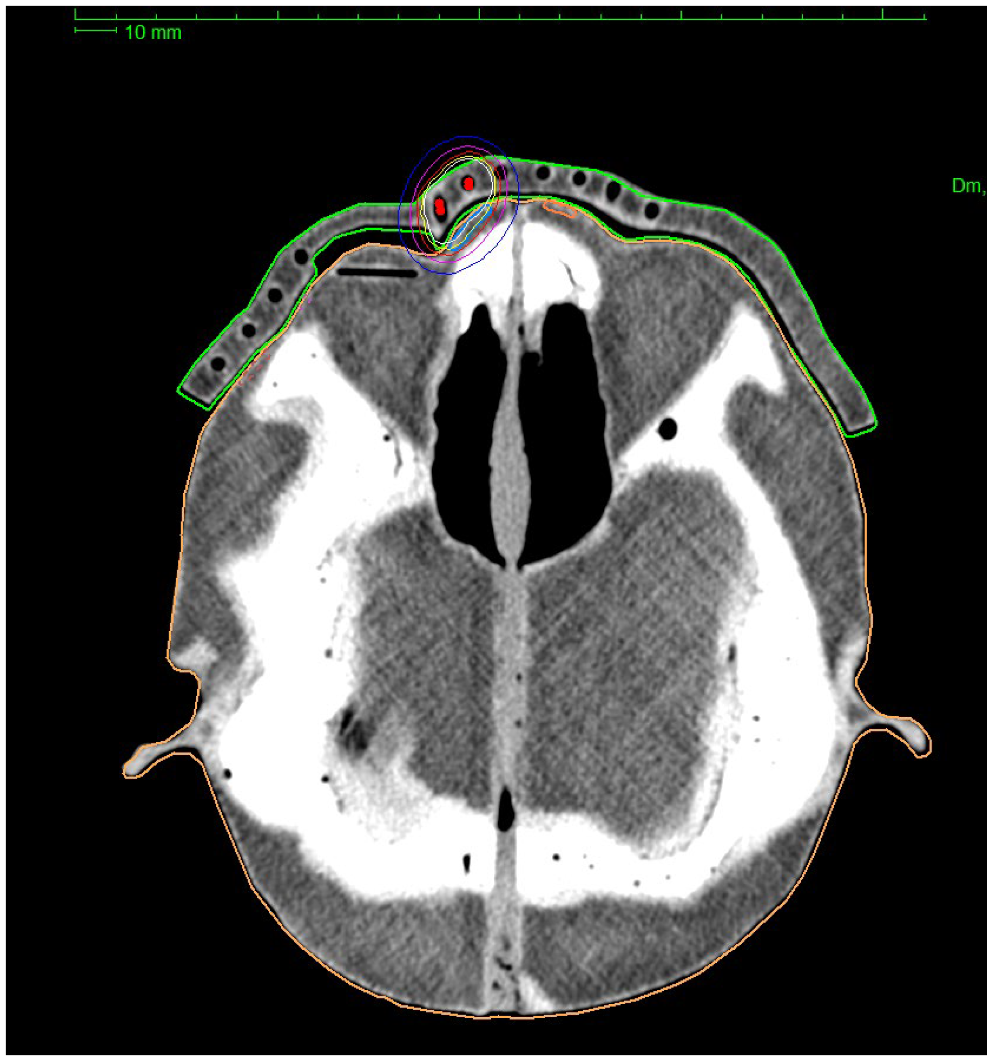 Jpm 12 01432 g007 550