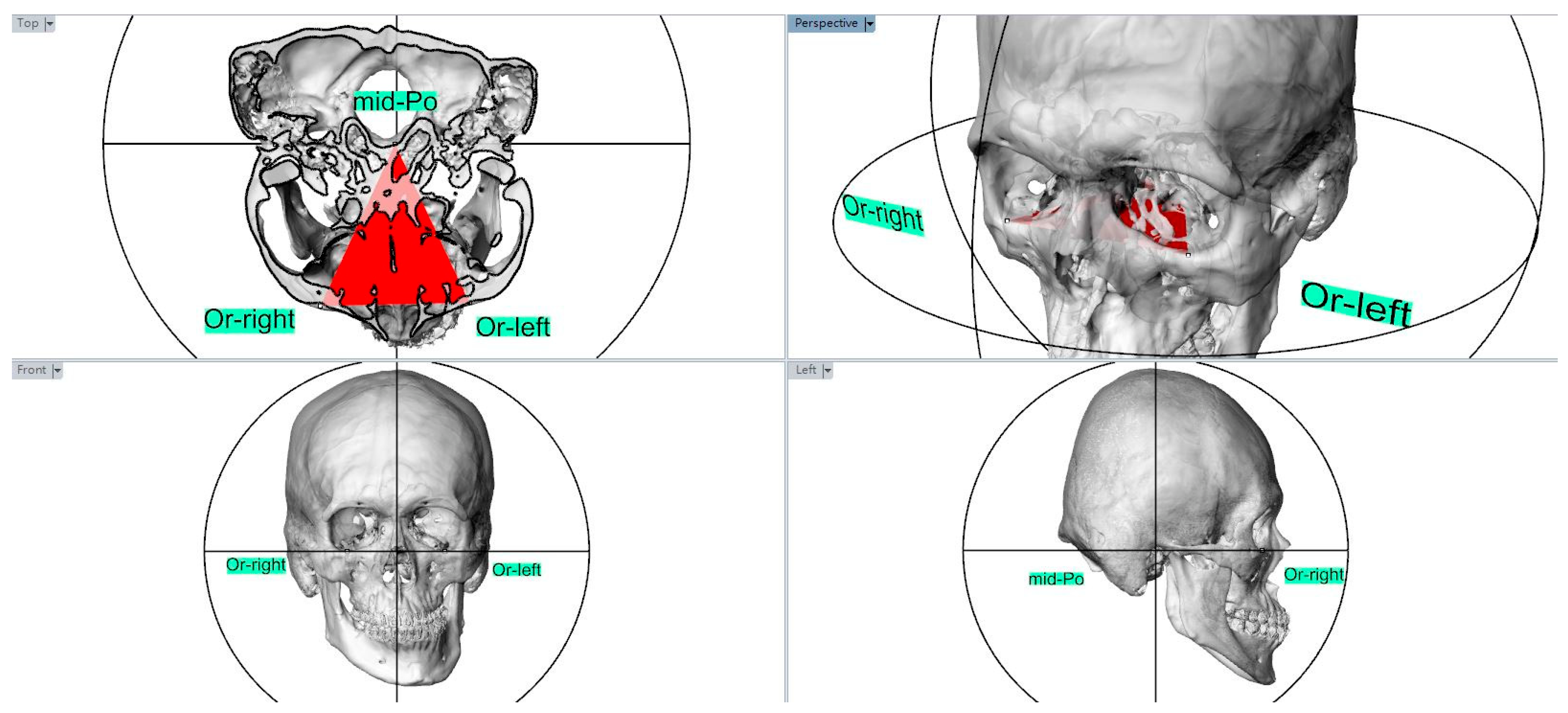 Jpm 12 01437 g001 550