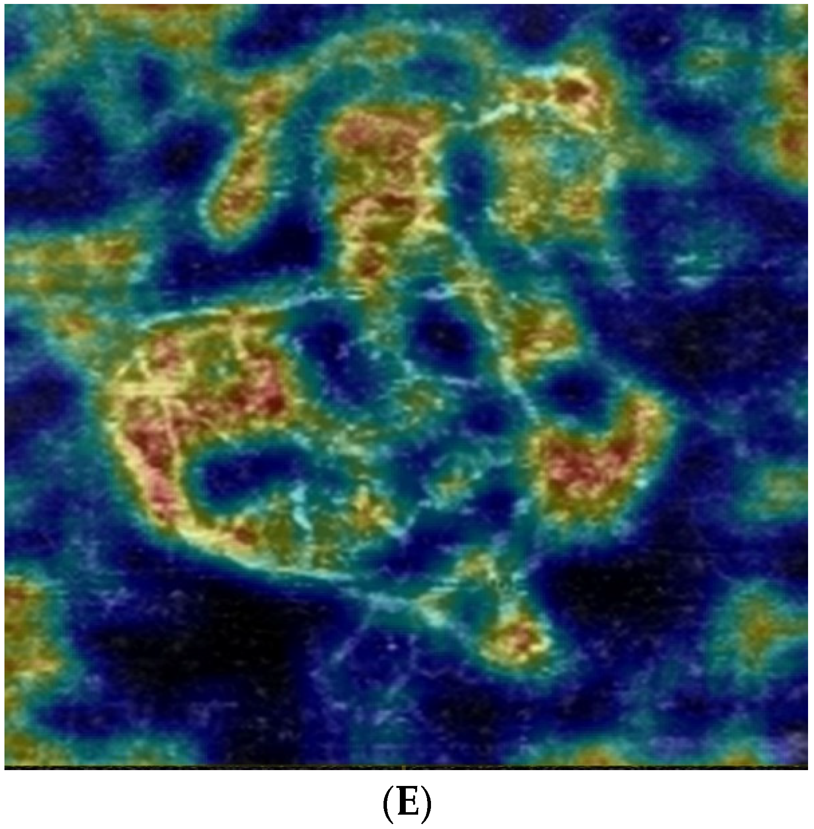 Jpm 12 01456 g001b 550