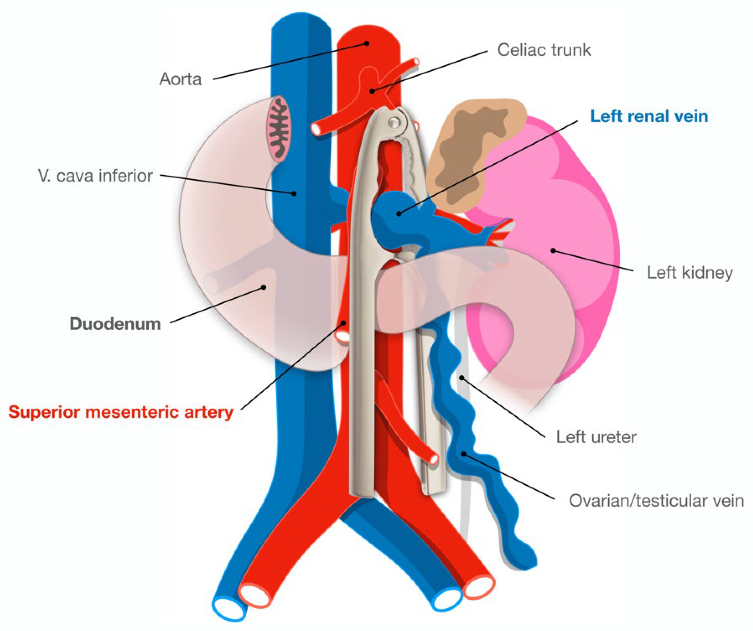 Winded (Solar Plexus Syndrome) - Symptoms, Causes and Treatment