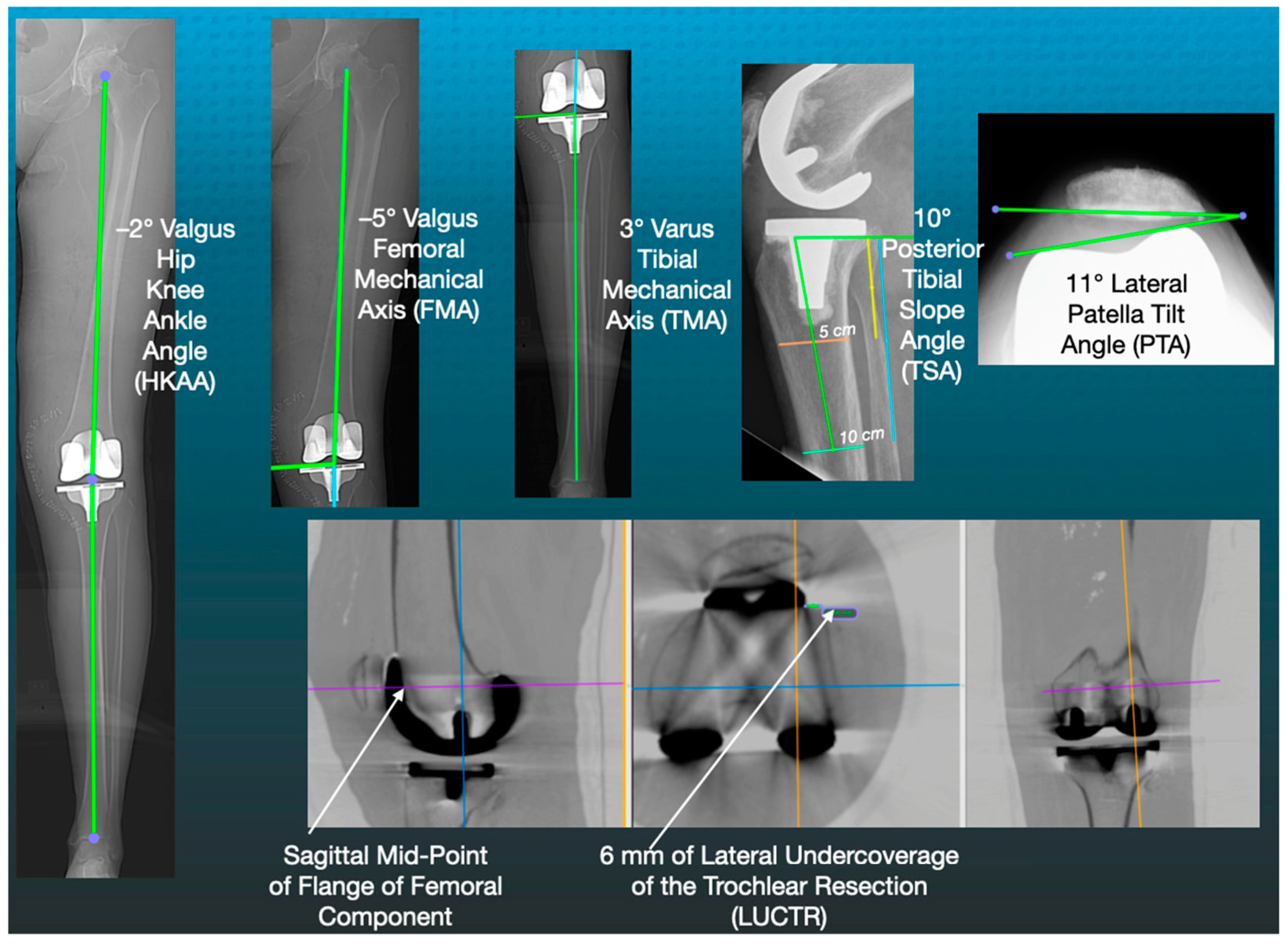 健康・医学 Aligner generation Full article: Clear aligners generations and orthodontic