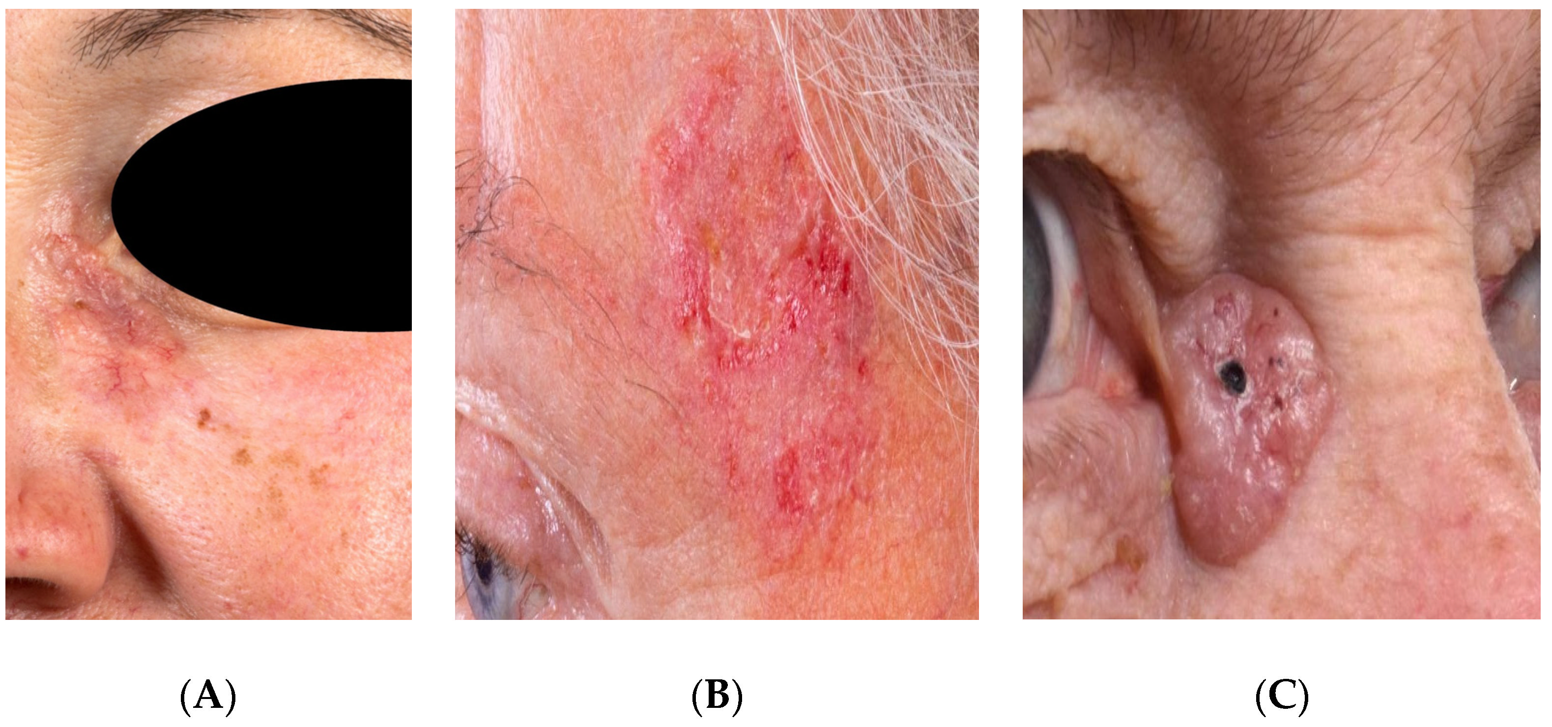 Jpm 12 01471 g001 550