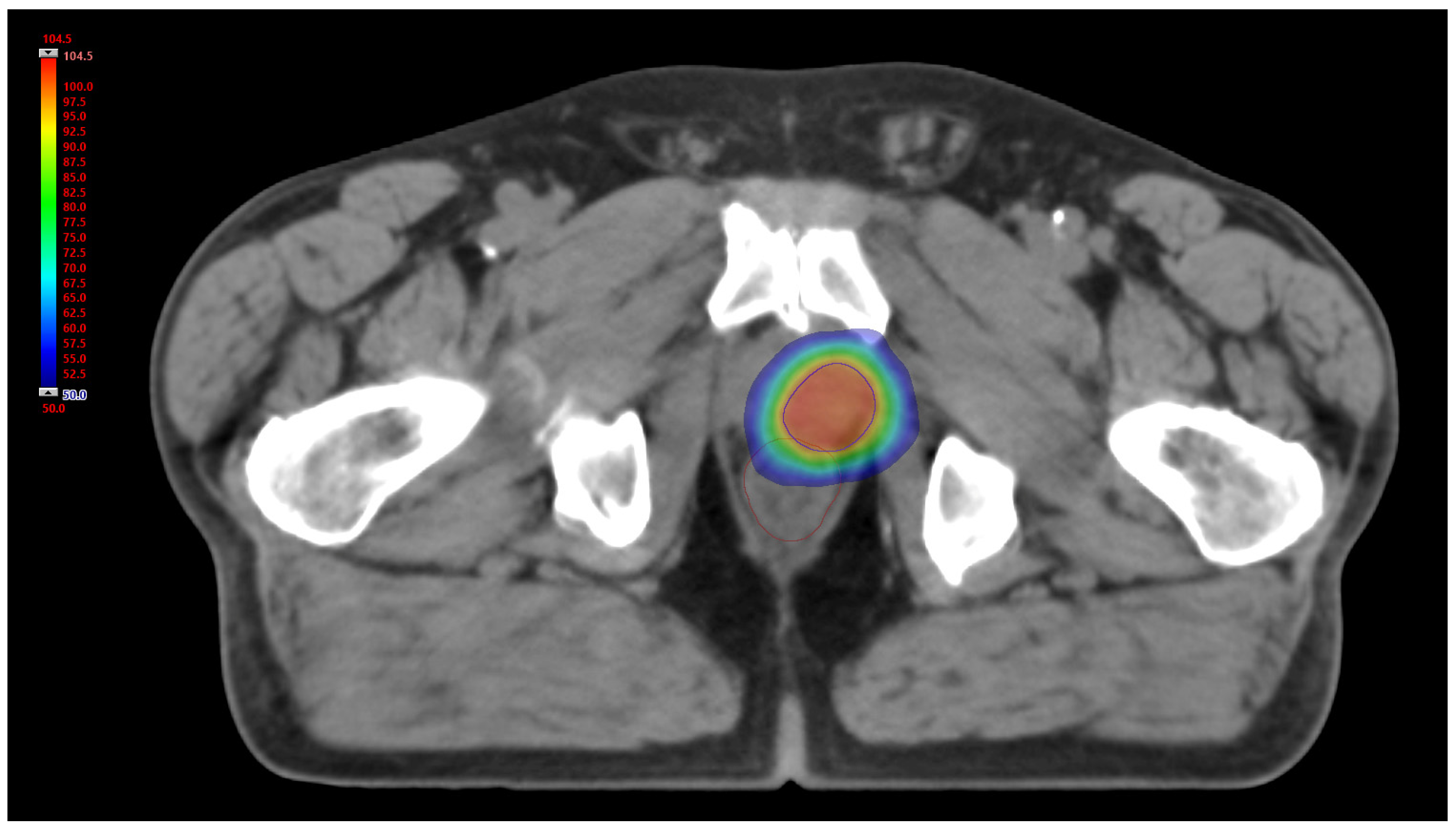 Jpm 12 01491 g002 550