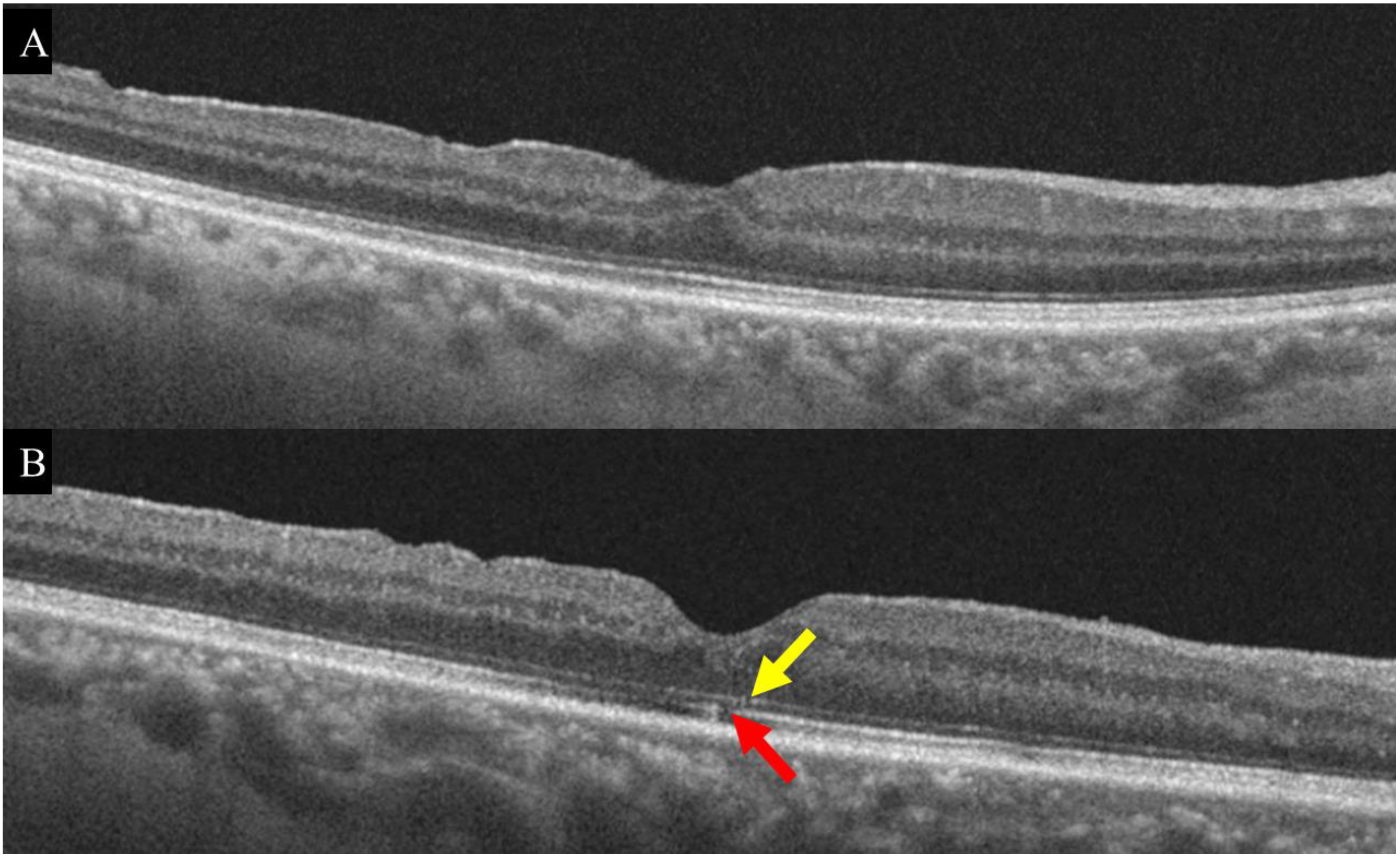 Jpm 12 01493 g001 550