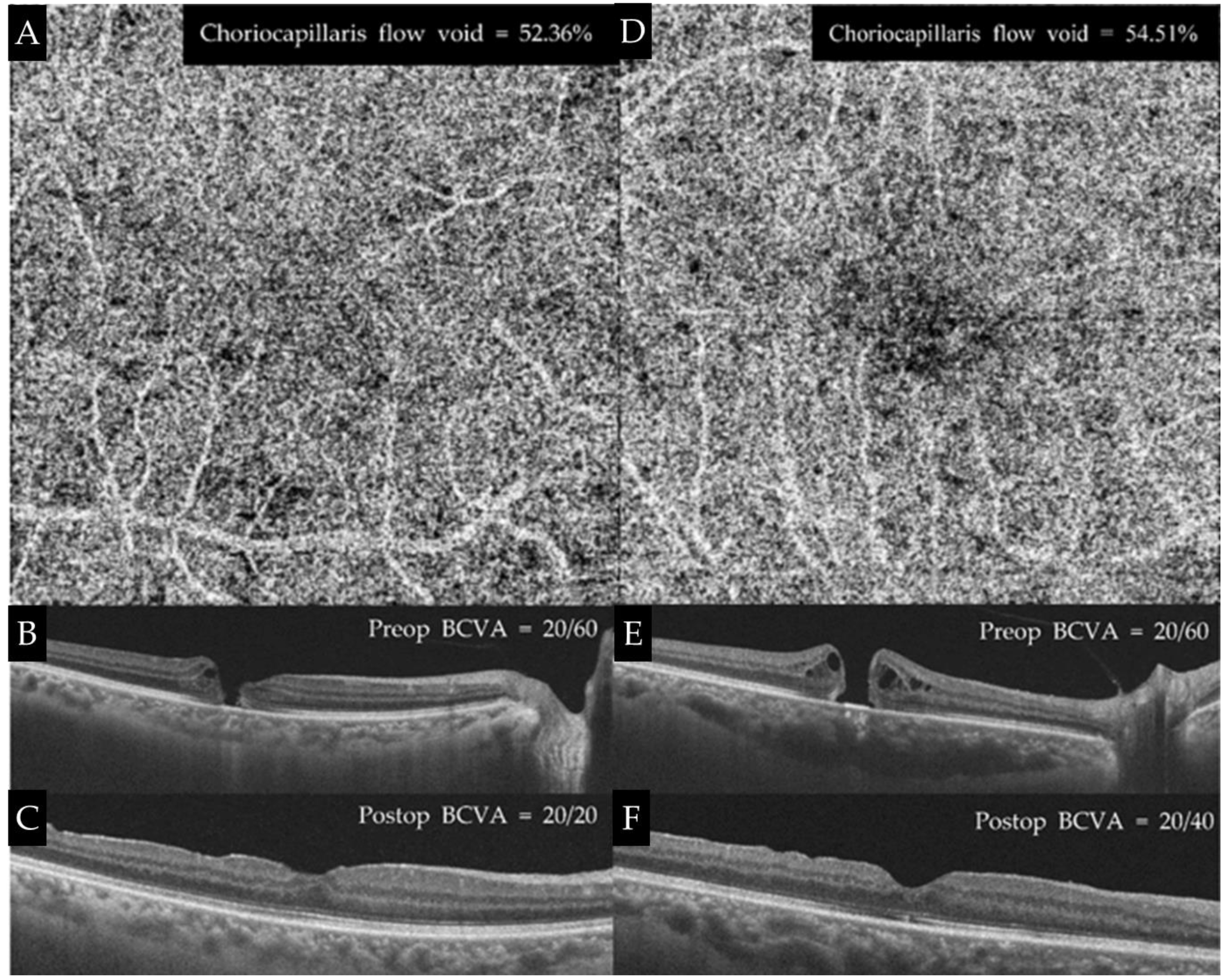Jpm 12 01493 g006 550