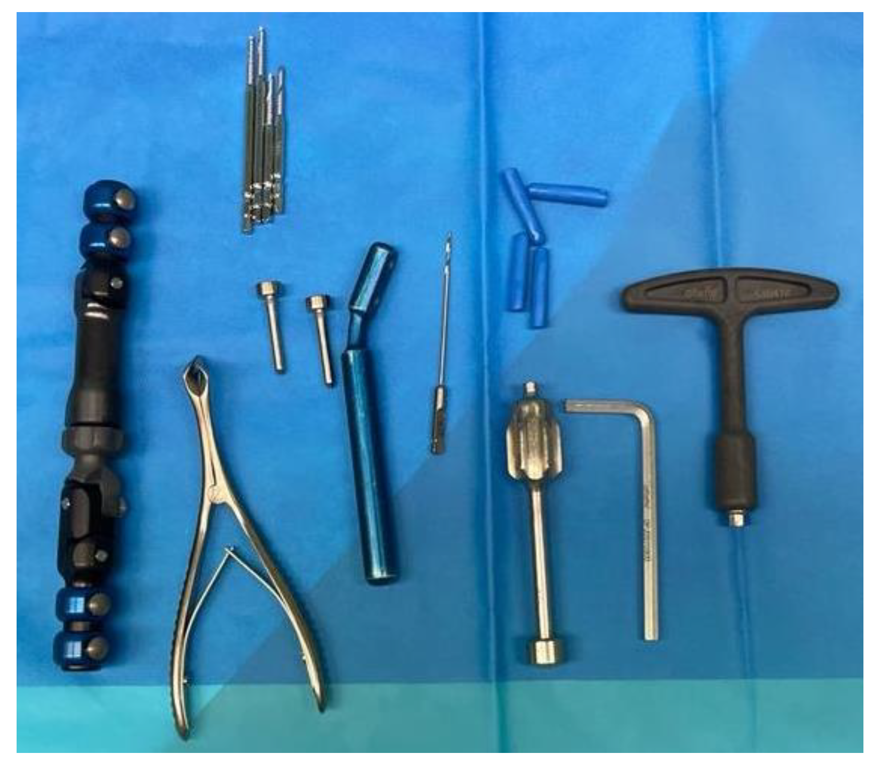 Ring external fixator (definitive) for Complete articular fracture,  fragmentary articular