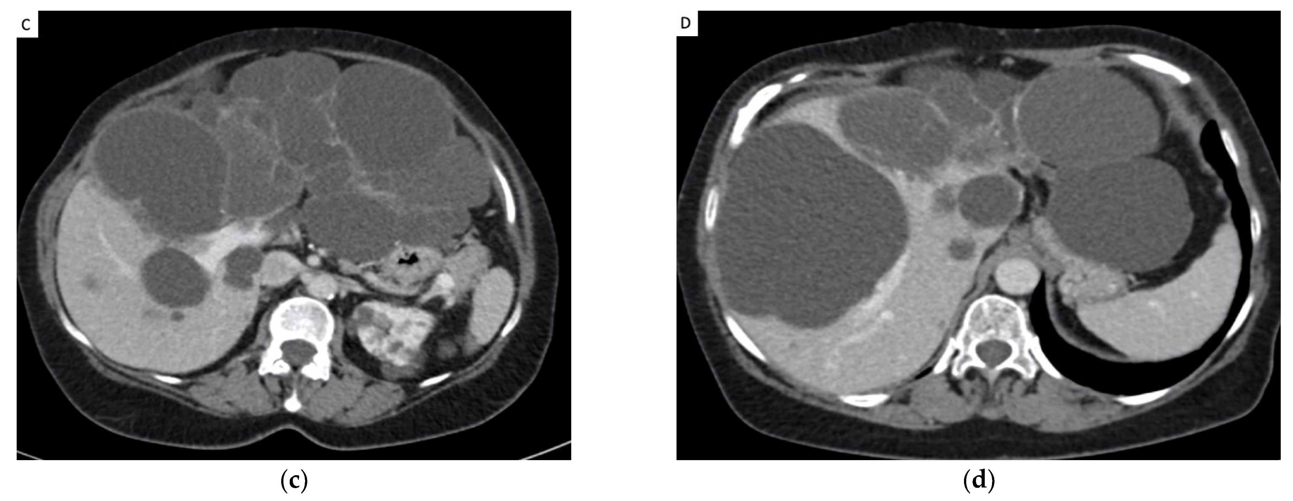 Jpm 12 01624 g001b Jpm 12 01624 g001b