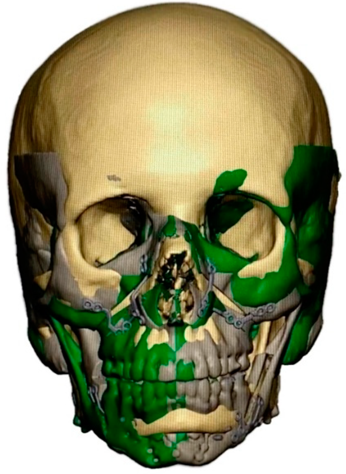 Jpm 12 01653 g005 Jpm 12 01653 g005