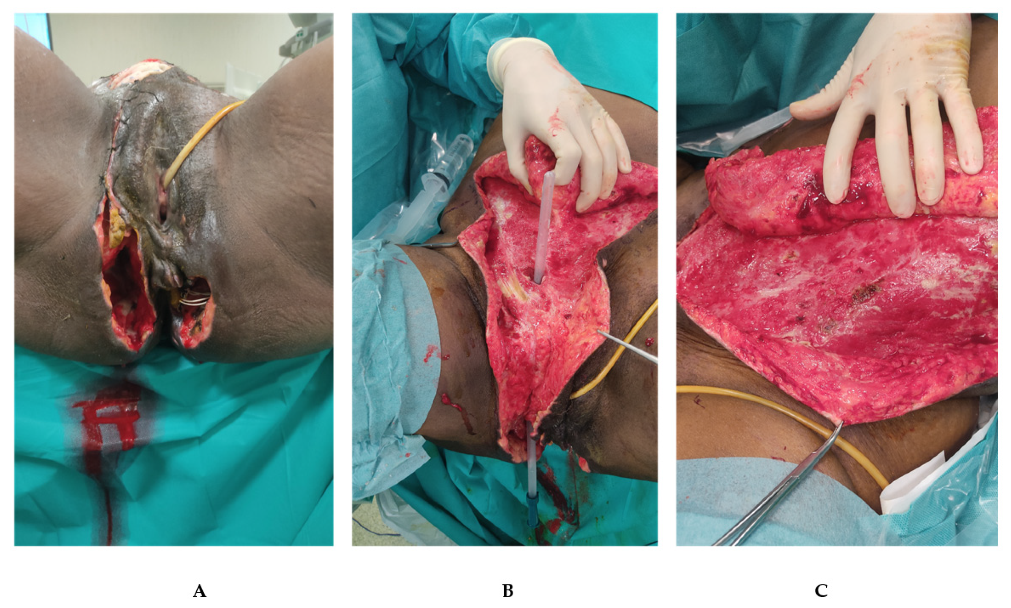 Jpm 12 01695 g002 Jpm 12 01695 g002