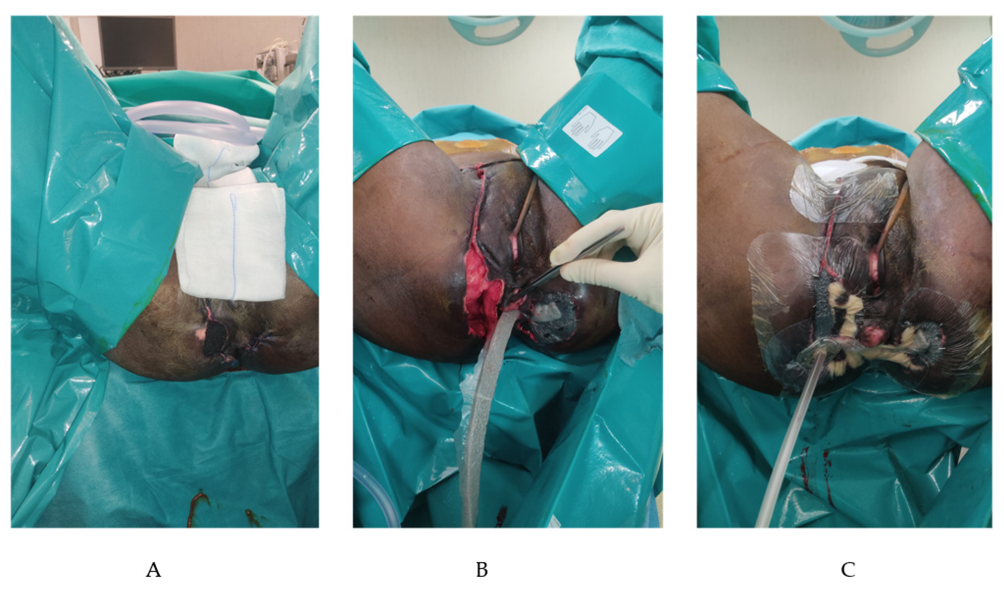 Jpm 12 01695 g003 Jpm 12 01695 g003