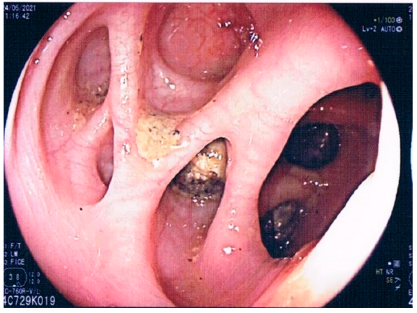 Jpm 12 01713 g003 Jpm 12 01713 g003