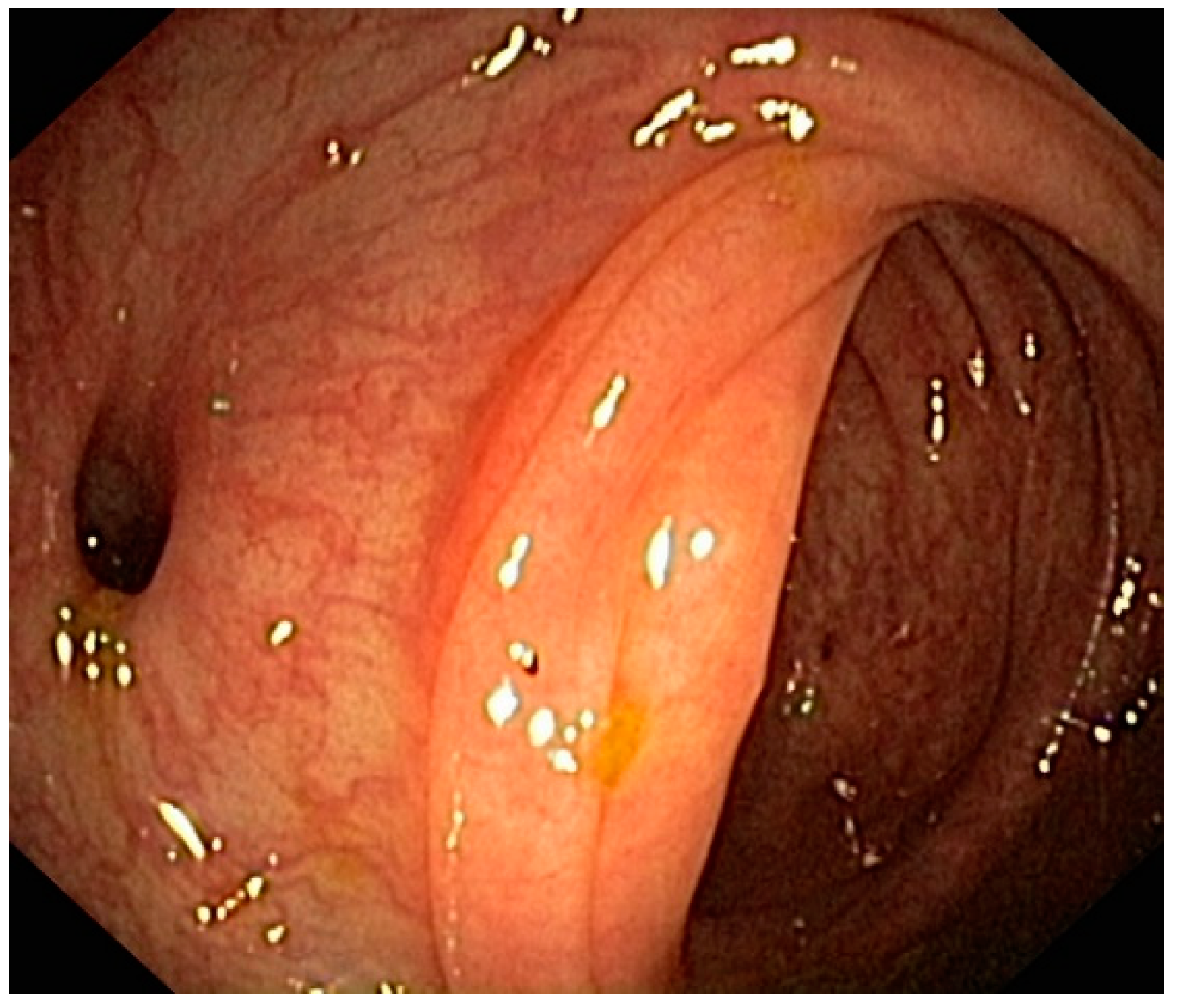 Jpm 12 01713 g004 Jpm 12 01713 g004