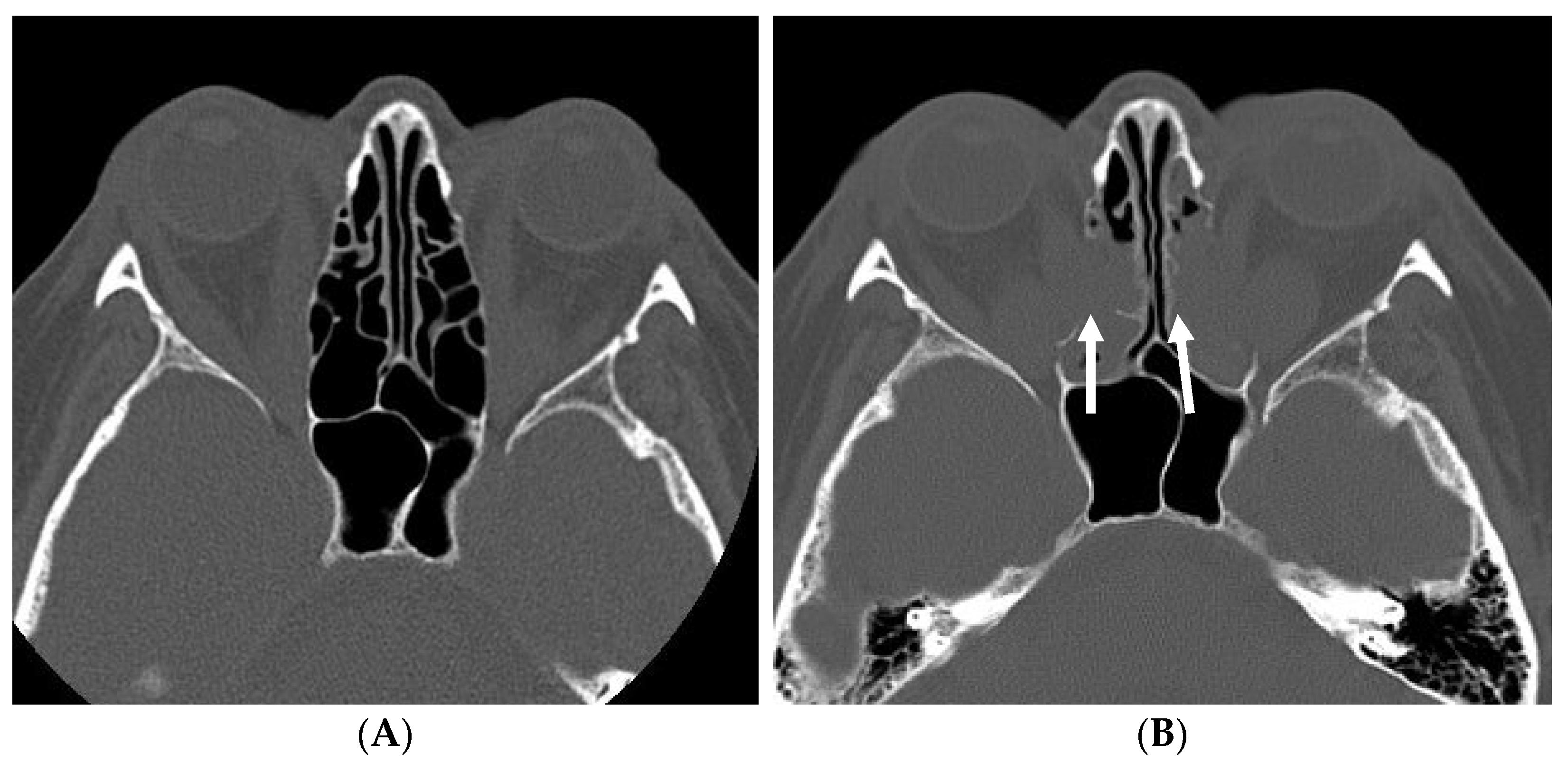 Jpm 12 01714 g001 Jpm 12 01714 g001