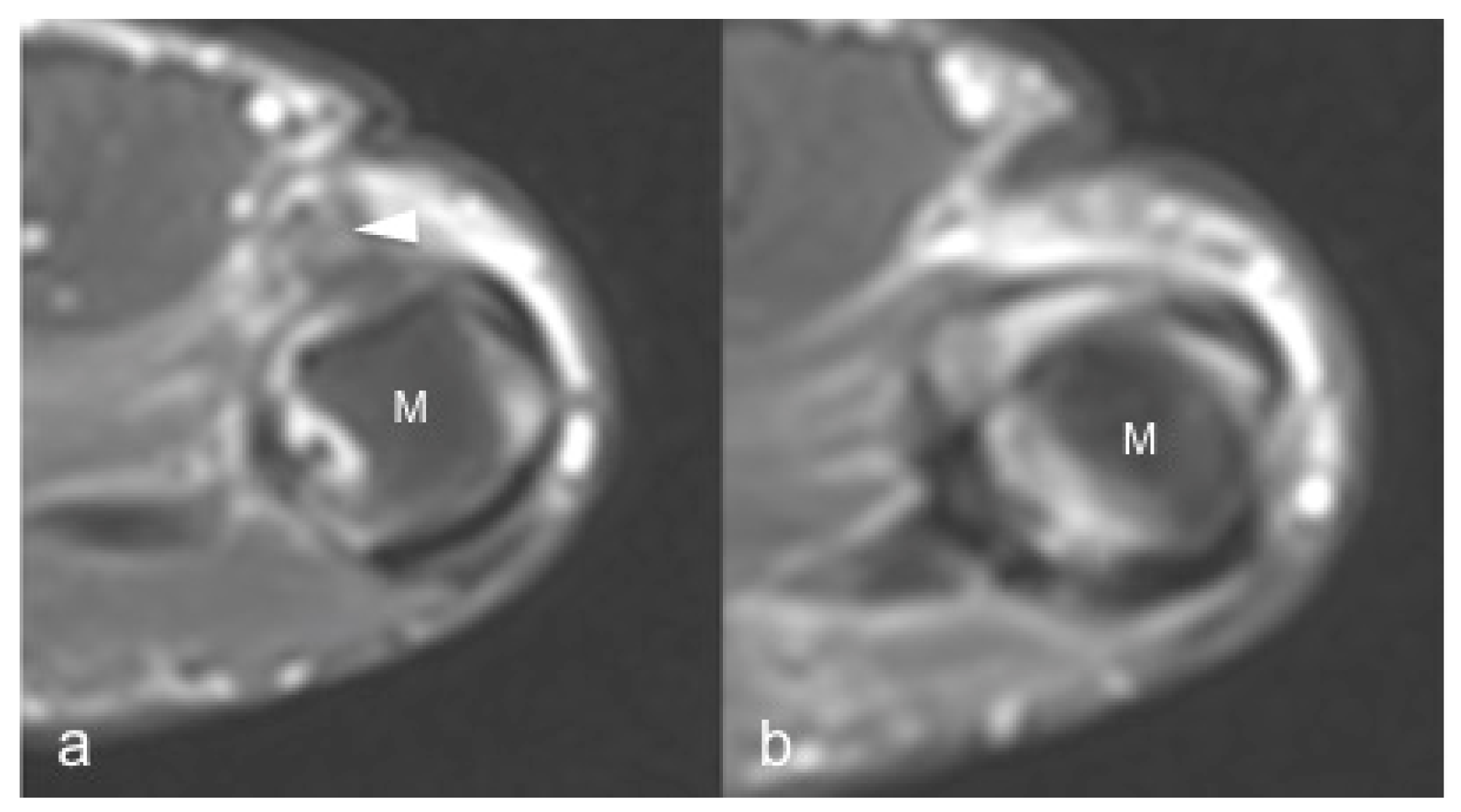 Jpm 12 01733 g008 Jpm 12 01733 g008