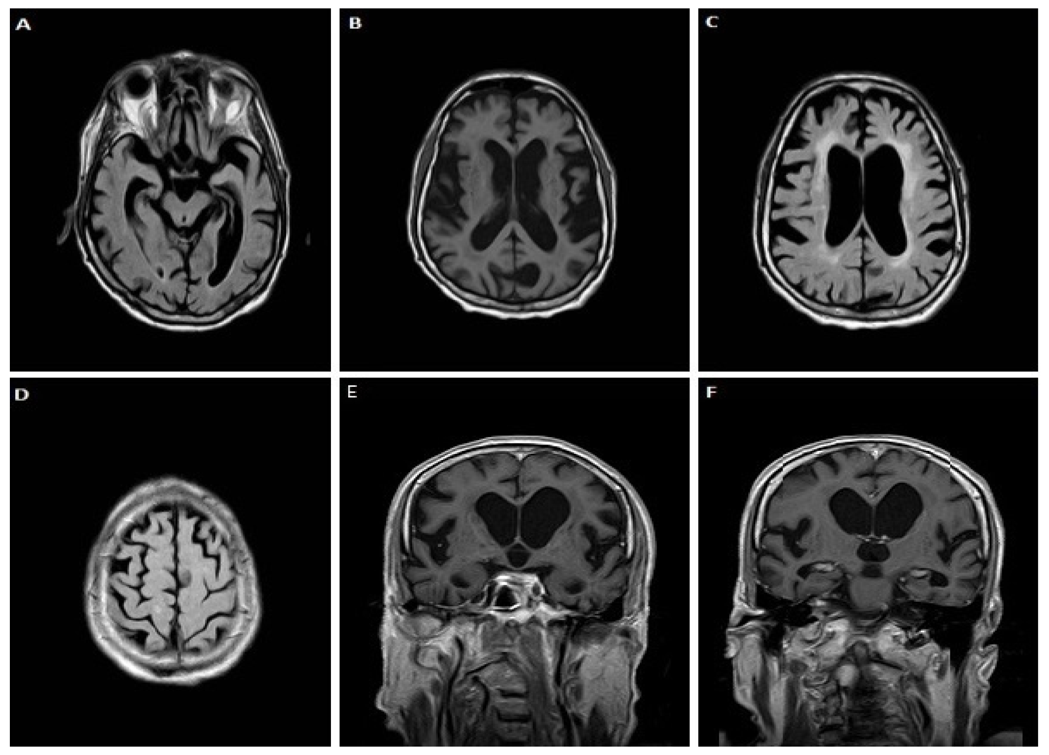 Jpm 12 01747 g003 Jpm 12 01747 g003