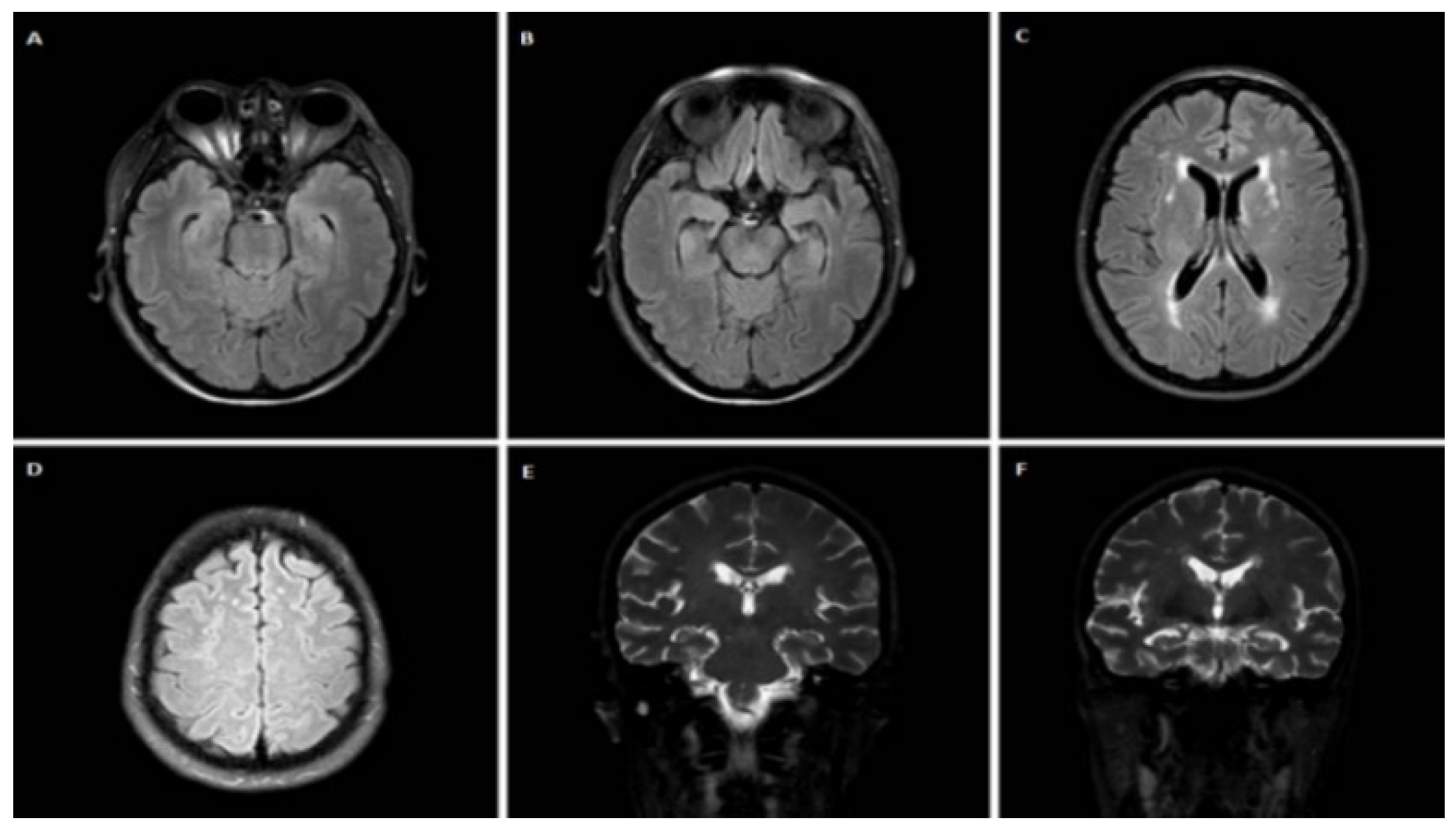 Jpm 12 01747 g004 Jpm 12 01747 g004