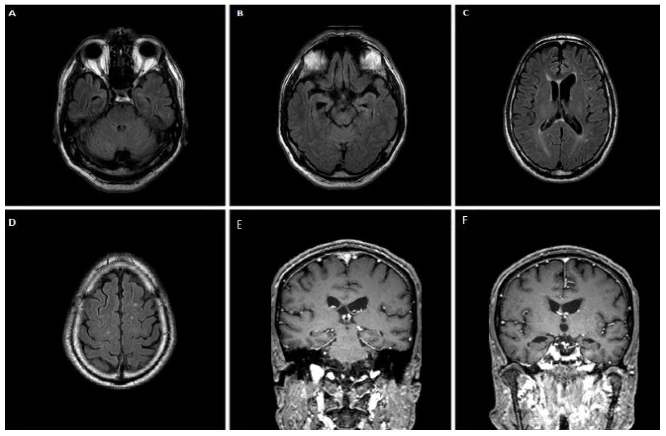 Jpm 12 01747 g005 Jpm 12 01747 g005