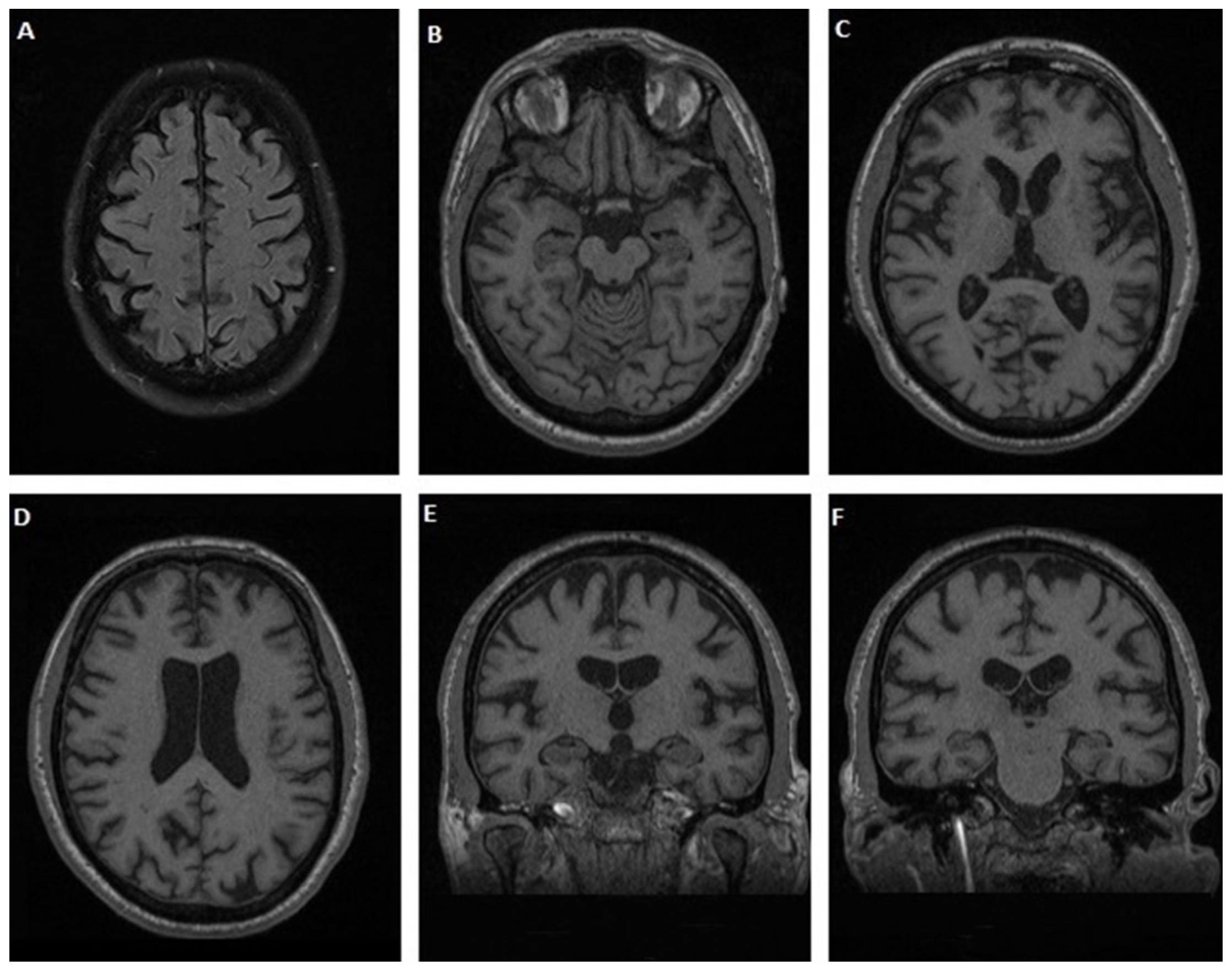 Jpm 12 01747 g006 Jpm 12 01747 g006