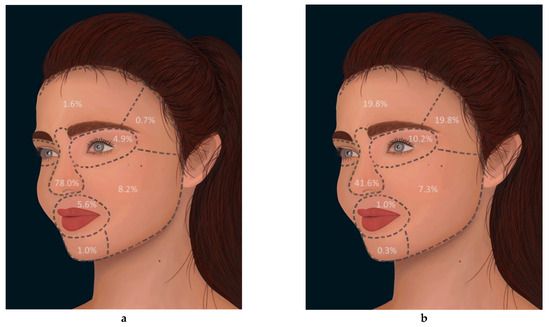 Risk Stratification of Local Flaps and Skin Grafting in Skin