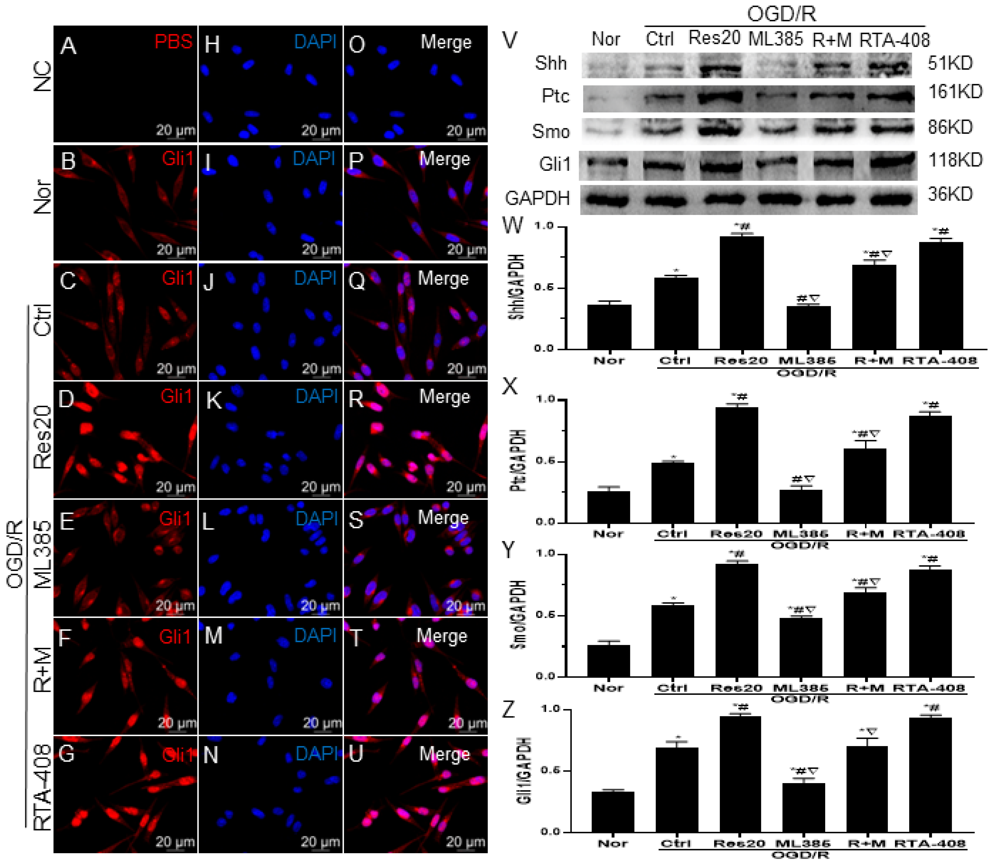 JPM Free FullText Resveratrol Inhibits Oxidative Stress and Regulates M1/M2Type