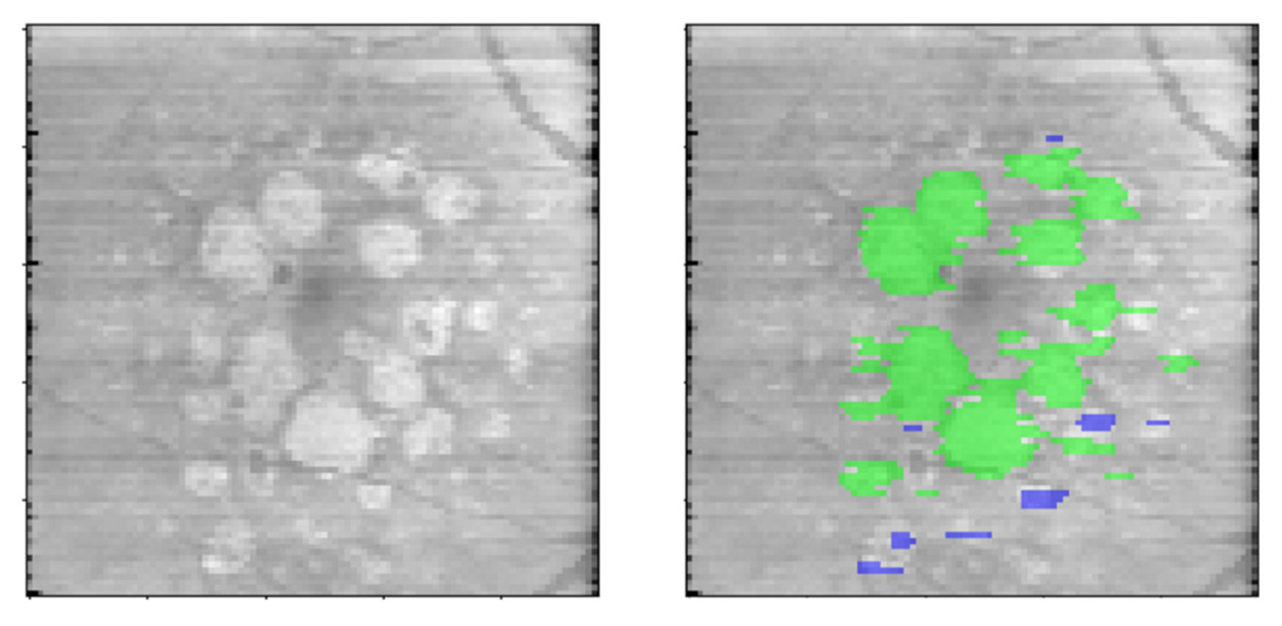 Jpm 13 00037 g003 Jpm 13 00037 g003