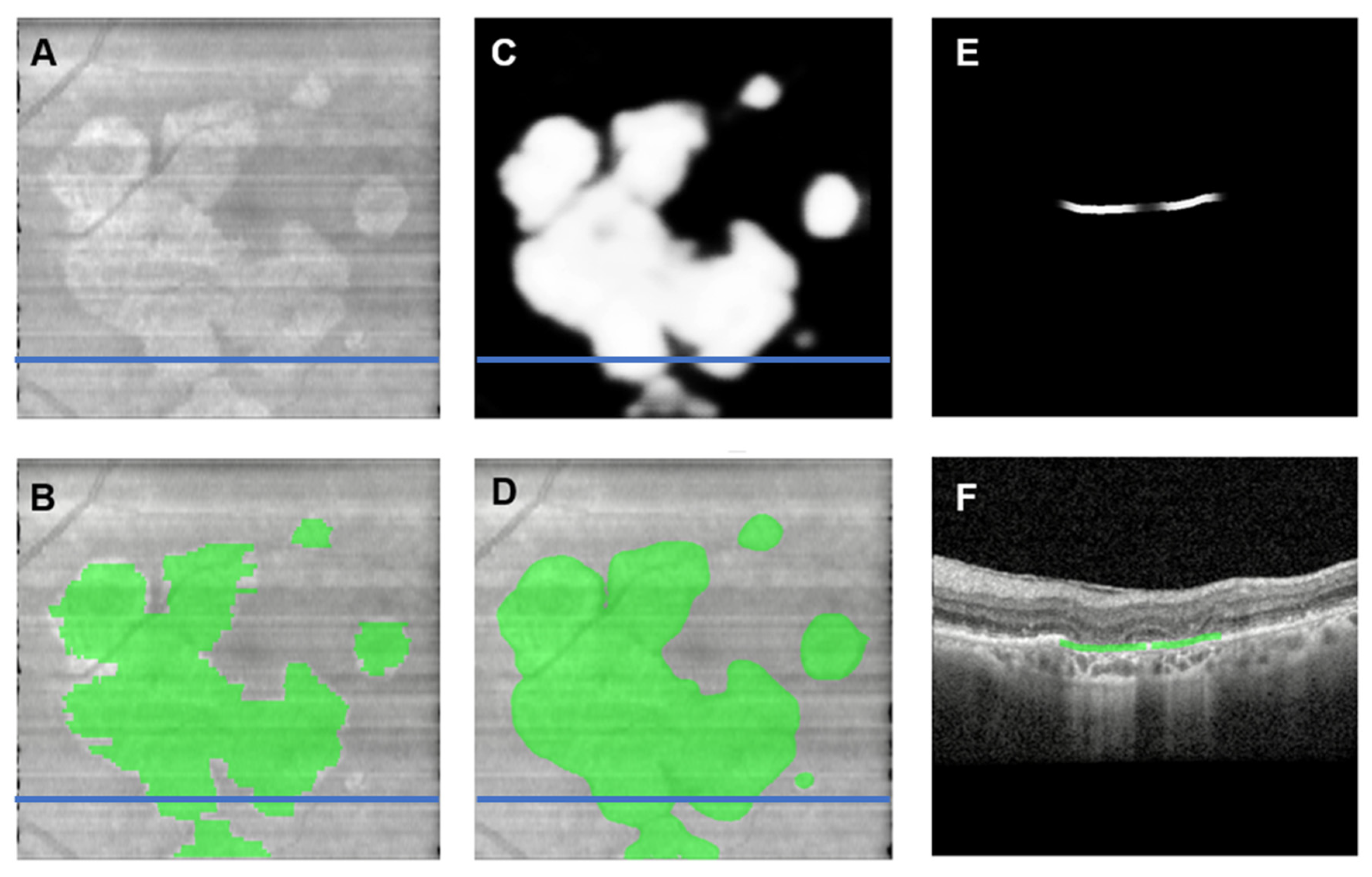 Jpm 13 00037 g006 Jpm 13 00037 g006