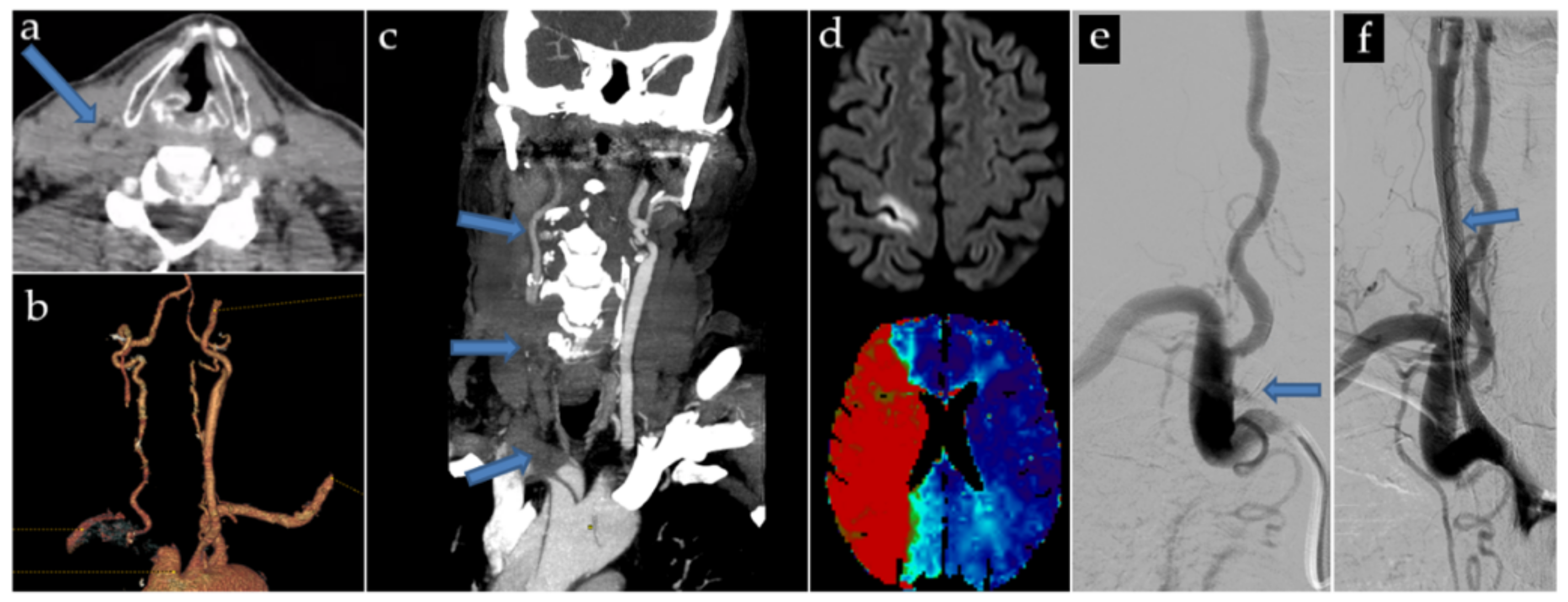 Jpm 13 00058 g002 Jpm 13 00058 g002