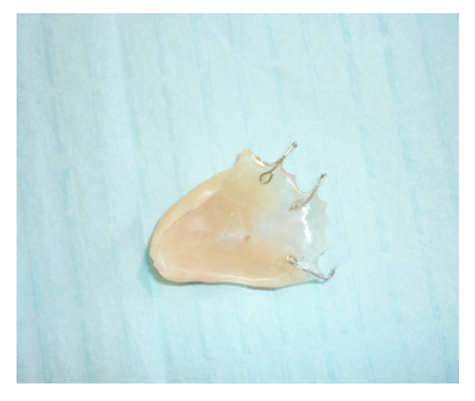 Jpm 13 00065 g006 Jpm 13 00065 g006