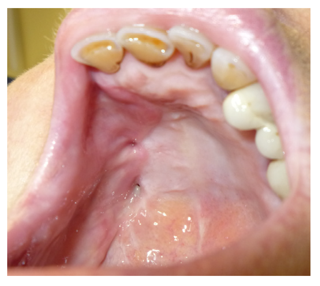 Jpm 13 00065 g007 Jpm 13 00065 g007