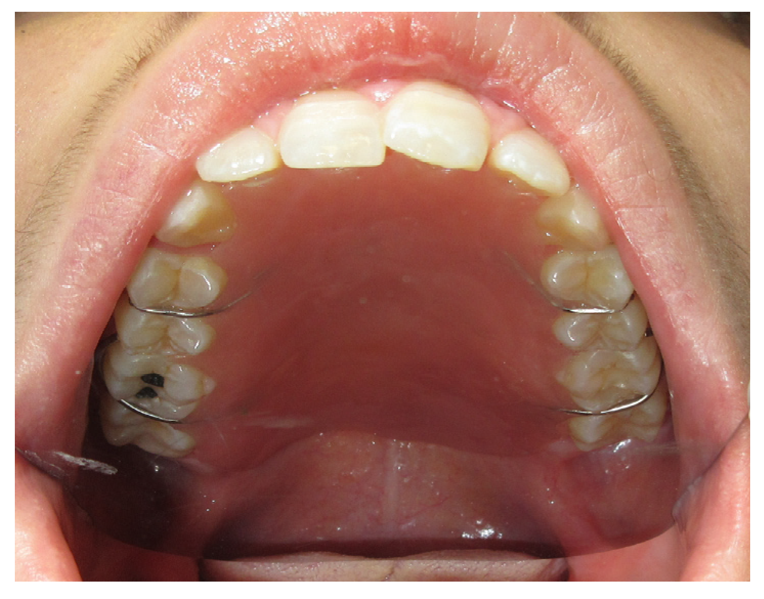 Jpm 13 00065 g010 Jpm 13 00065 g010