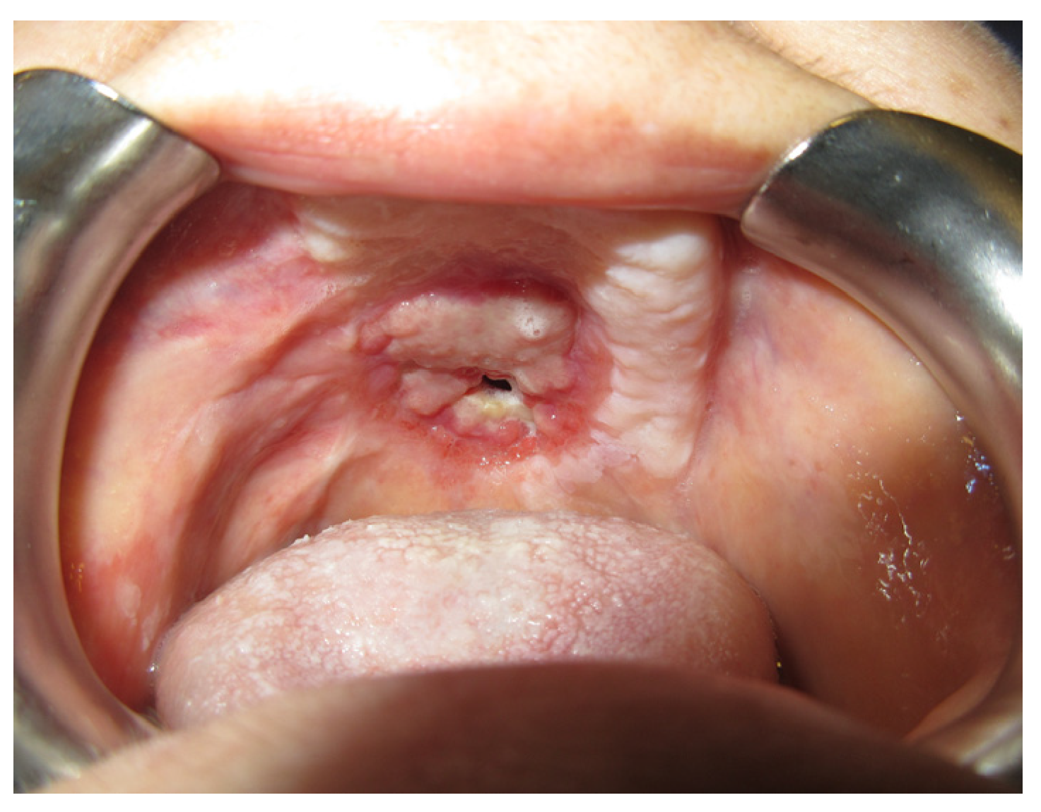 Jpm 13 00065 g016 Jpm 13 00065 g016