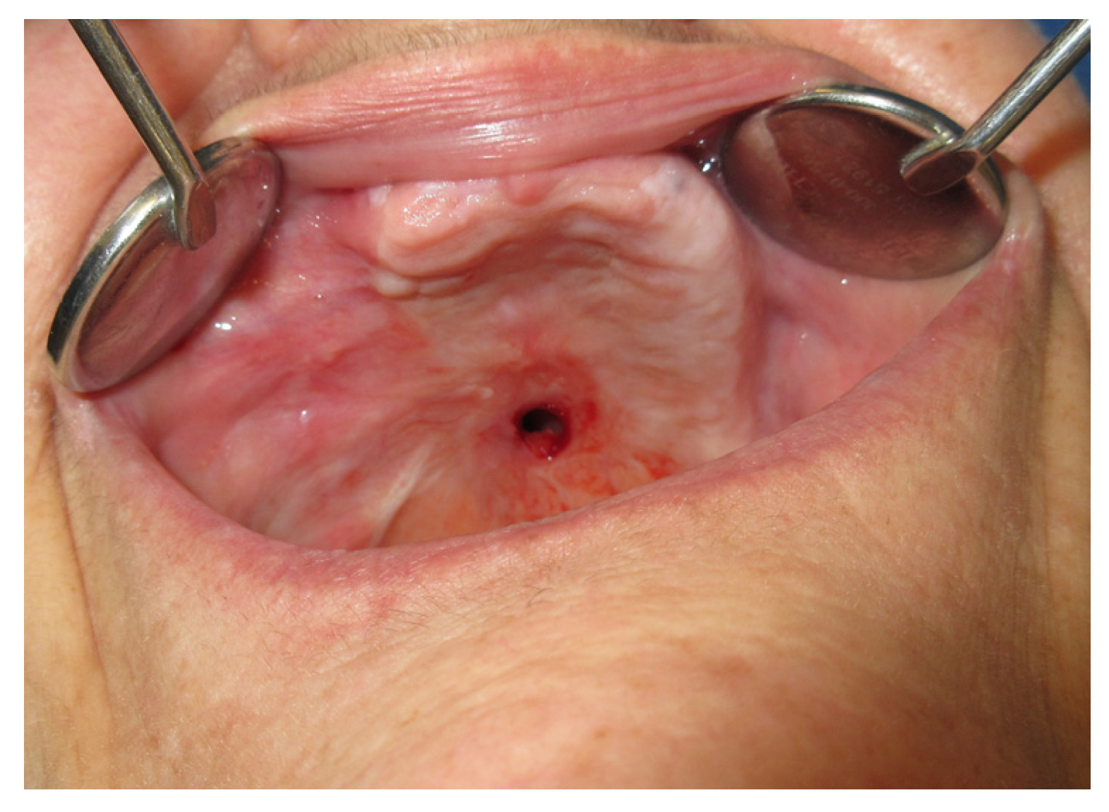 Jpm 13 00065 g017 Jpm 13 00065 g017