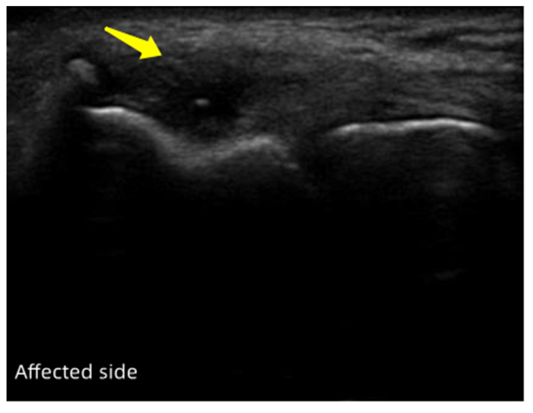 Jpm 13 00066 g002 Jpm 13 00066 g002