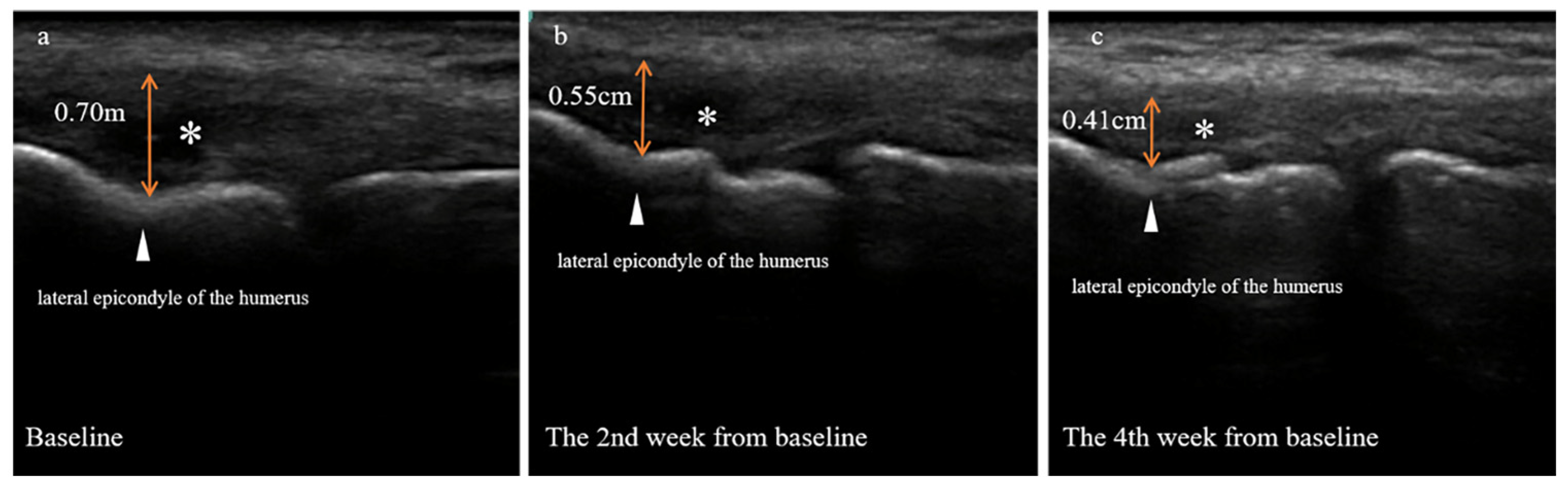Jpm 13 00066 g005 Jpm 13 00066 g005