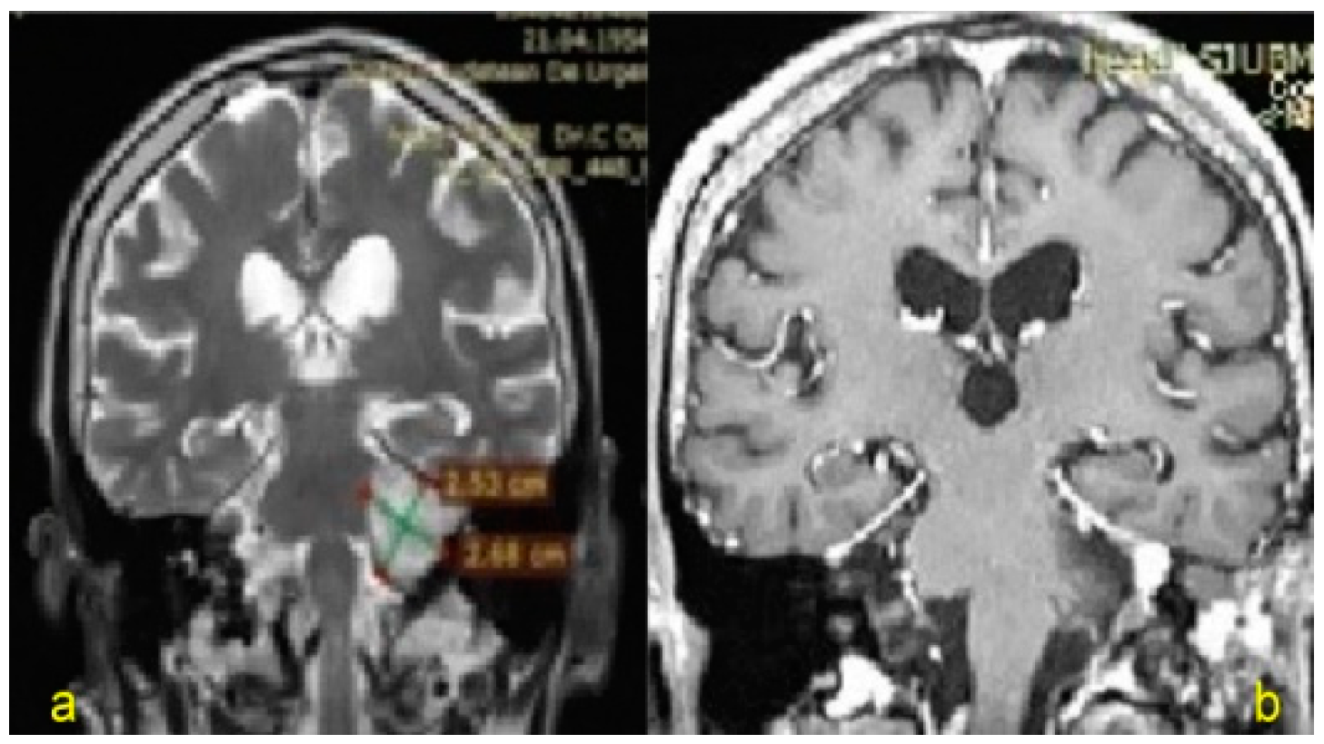 Jpm 13 00076 g002 Jpm 13 00076 g002