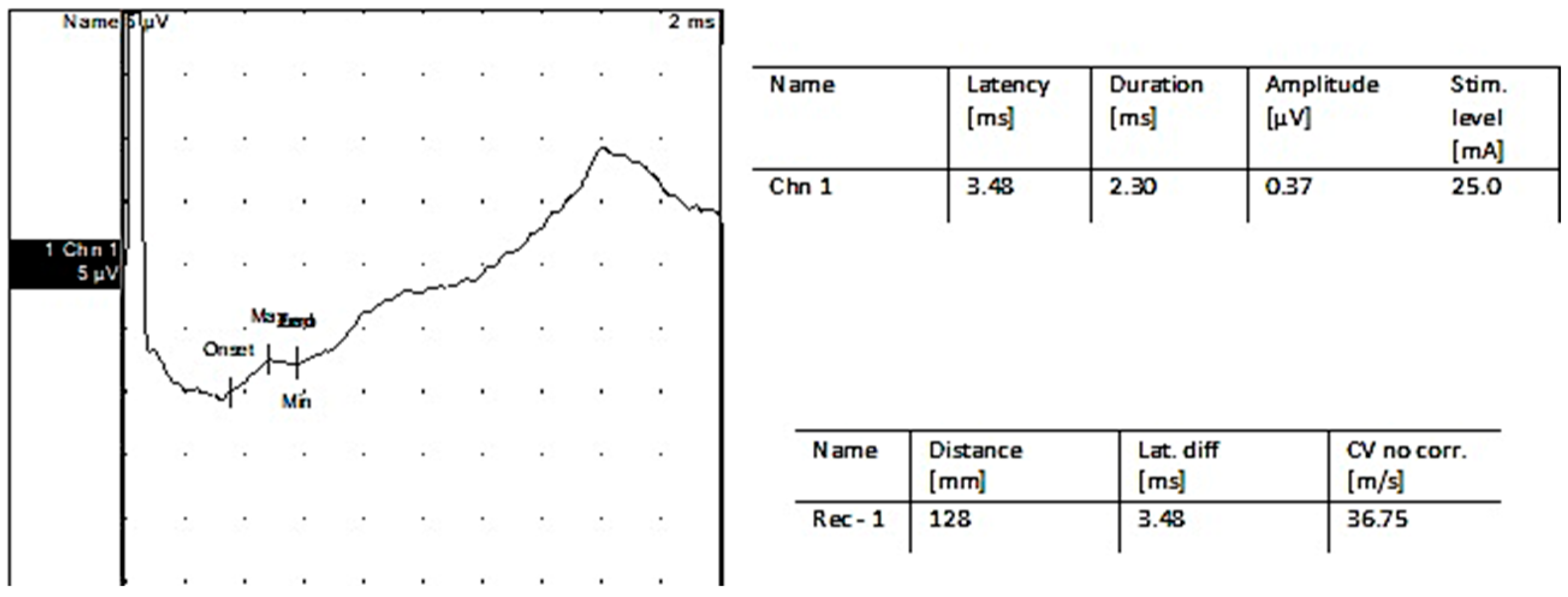 Jpm 13 00076 g004 Jpm 13 00076 g004